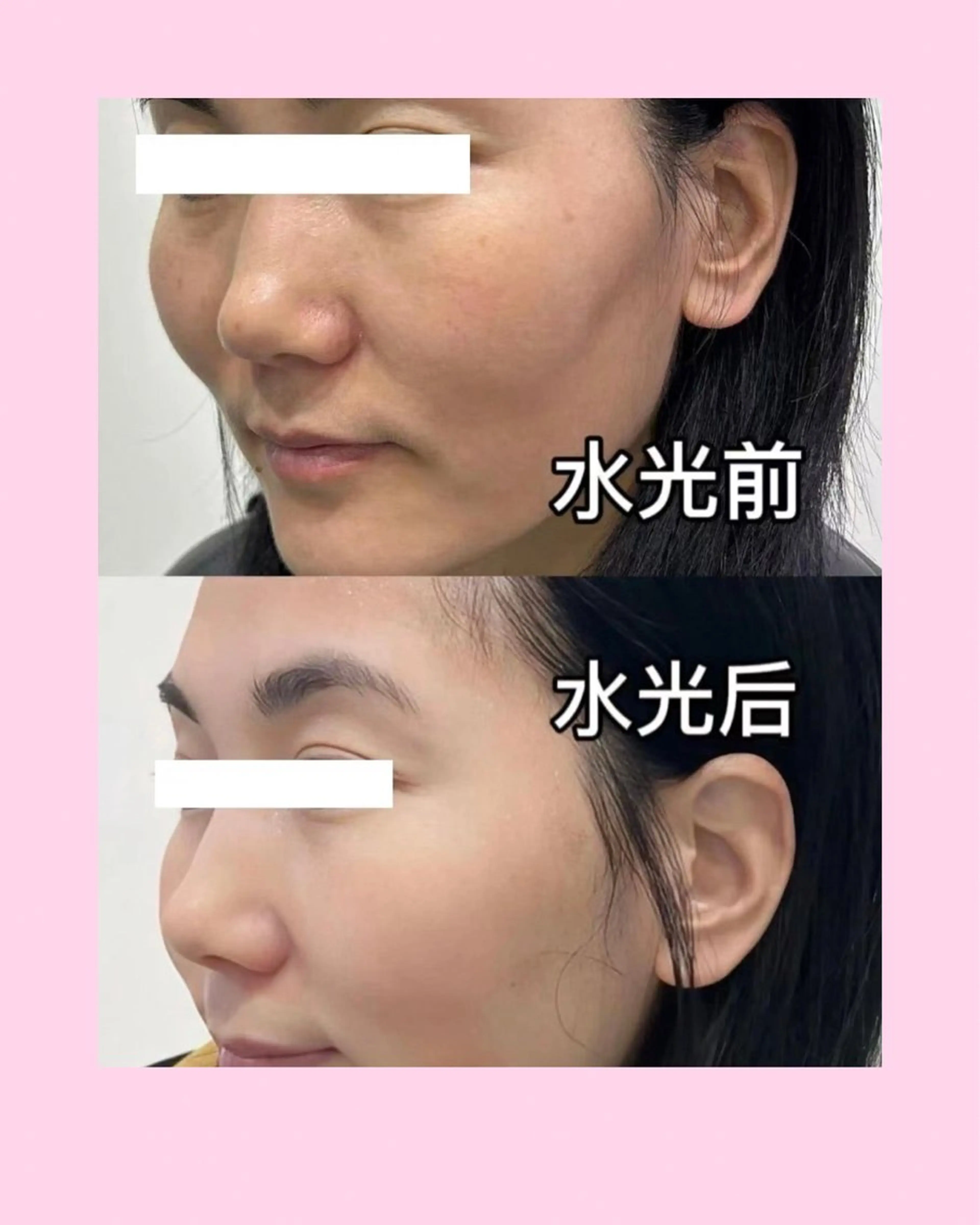マツエク・マツパ エステ リラク 愛維美水光美肌専門店 メンズレディースokのエステ・リラクイメージ