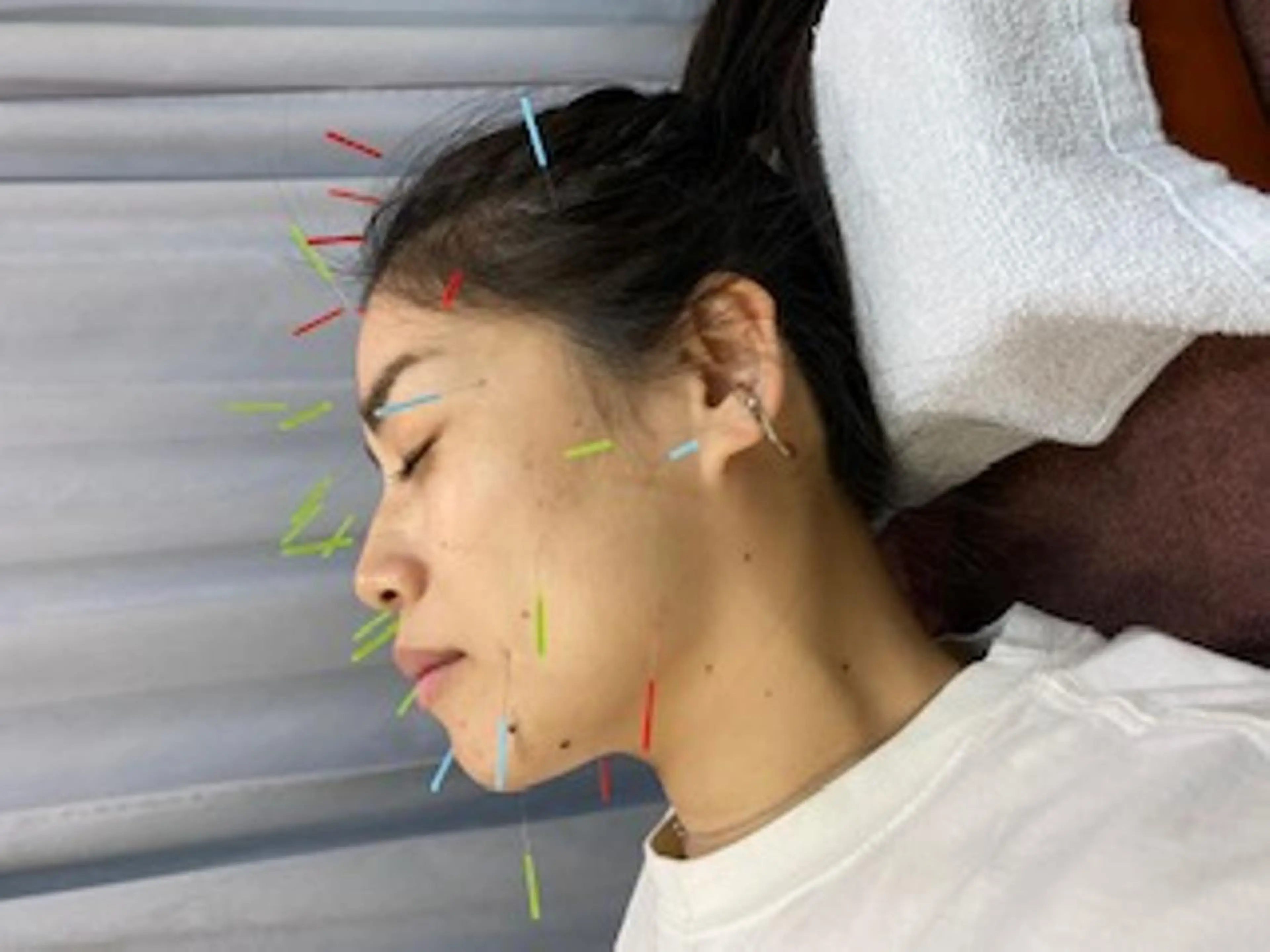 いとう 鍼灸整骨院のエステ・リラクイメージ