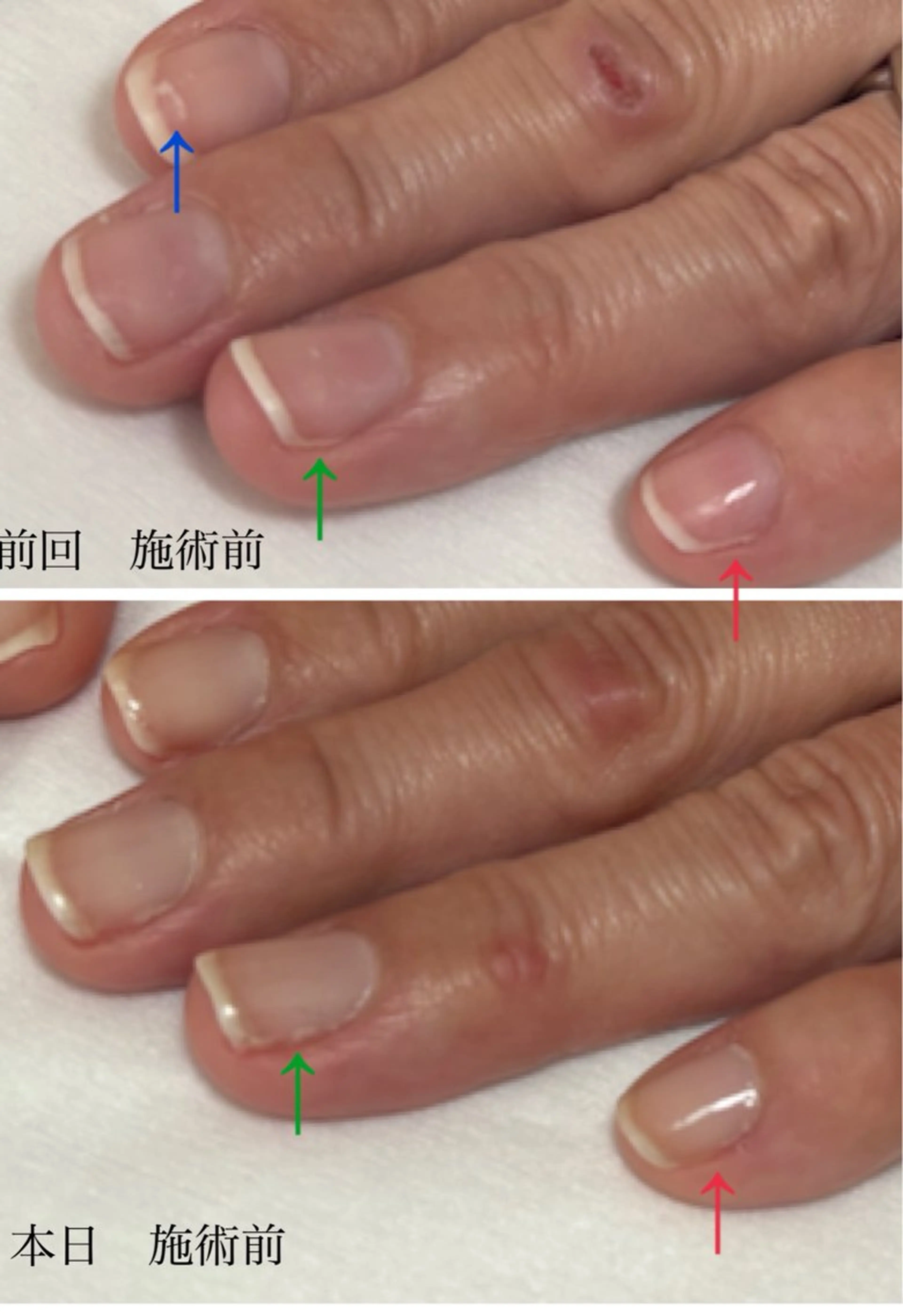 ネイル ジェルネイル Alo.nail アロ•ネイルのネイルデザイン