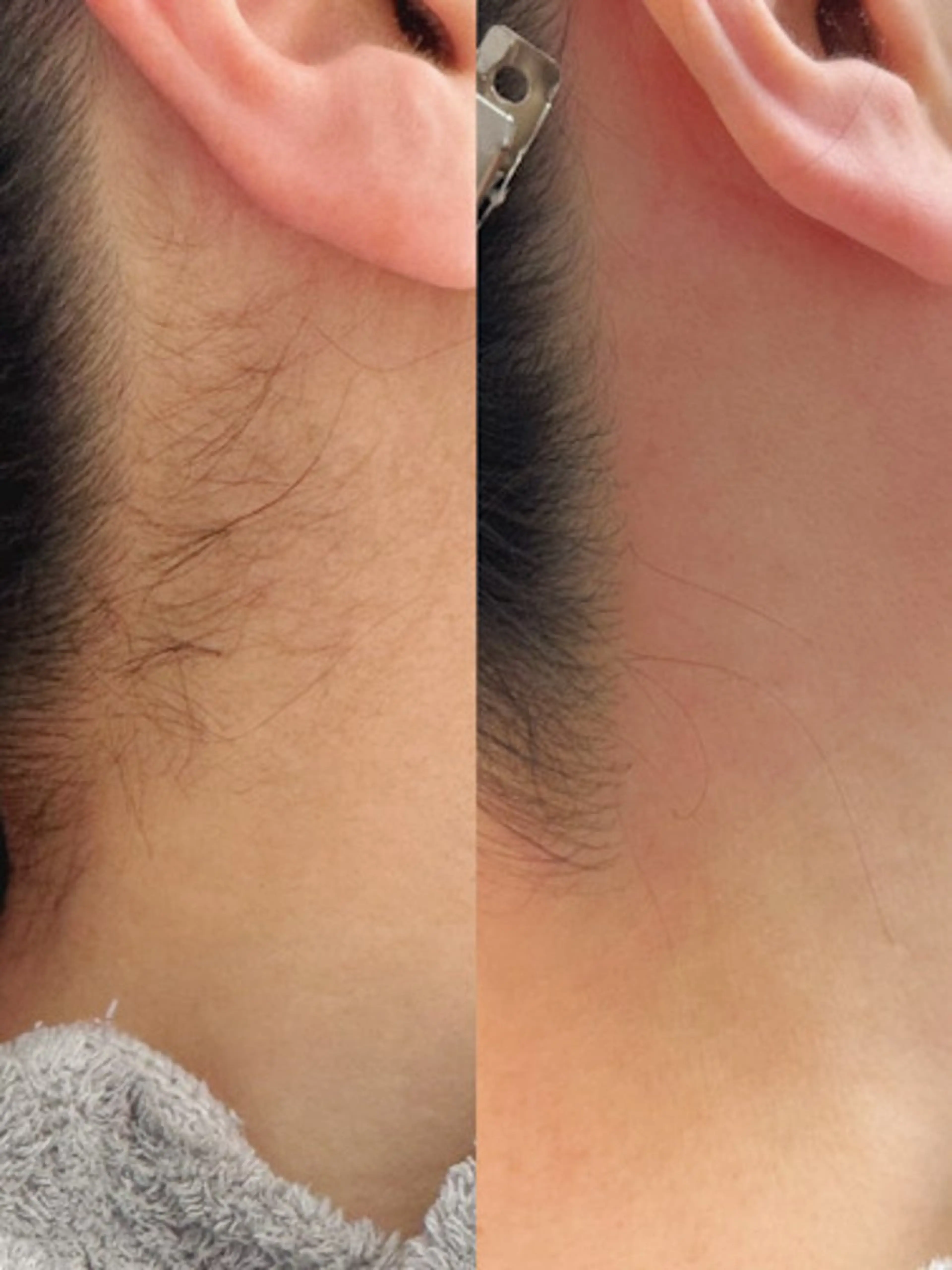 Hitomi シュガーリング豊橋のその他イメージ