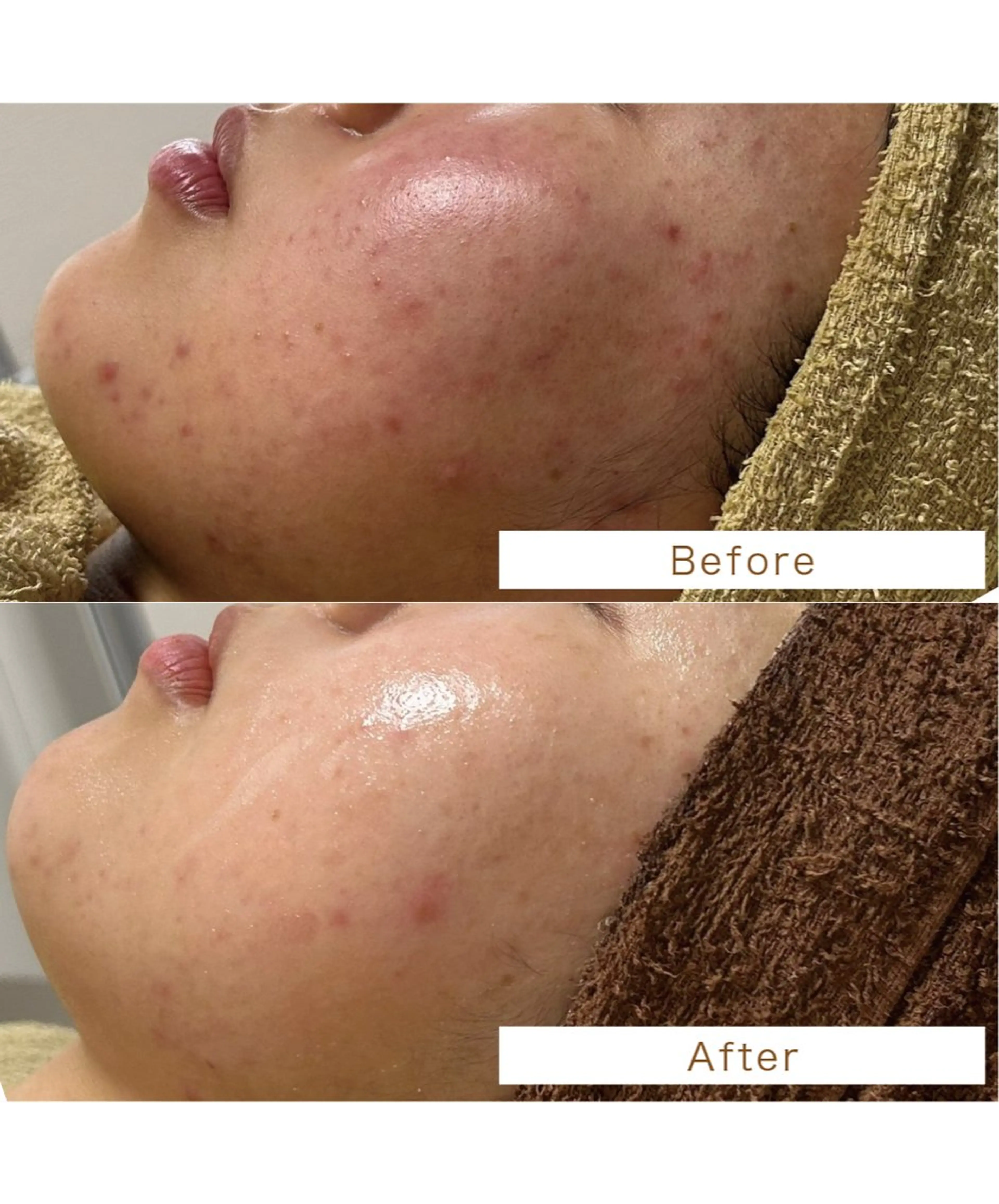 エステサロン .BX新人スタッフのエステ・リラクイメージ