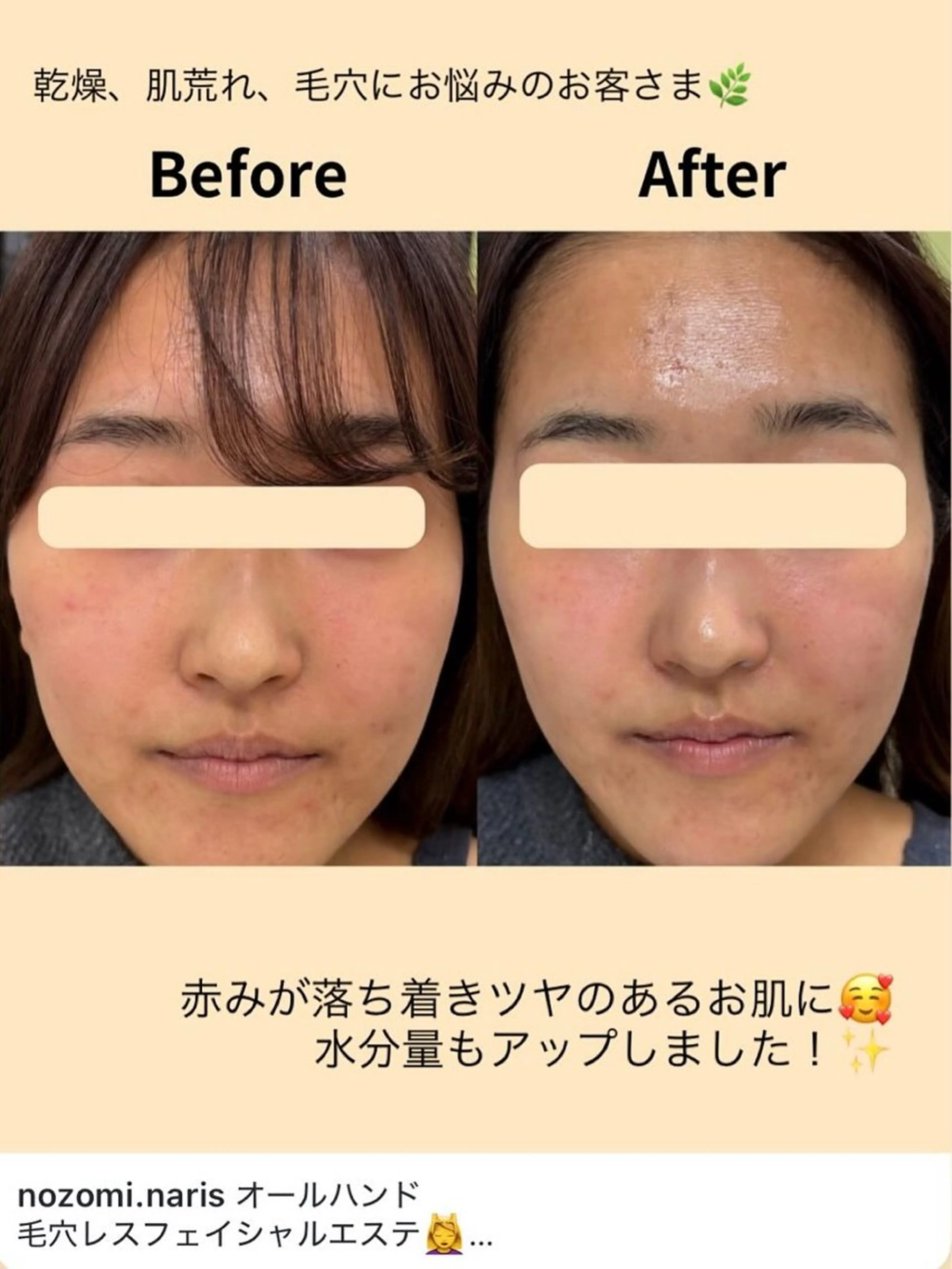 エステ nozomi.m🌷 narisのエステ・リラクイメージ