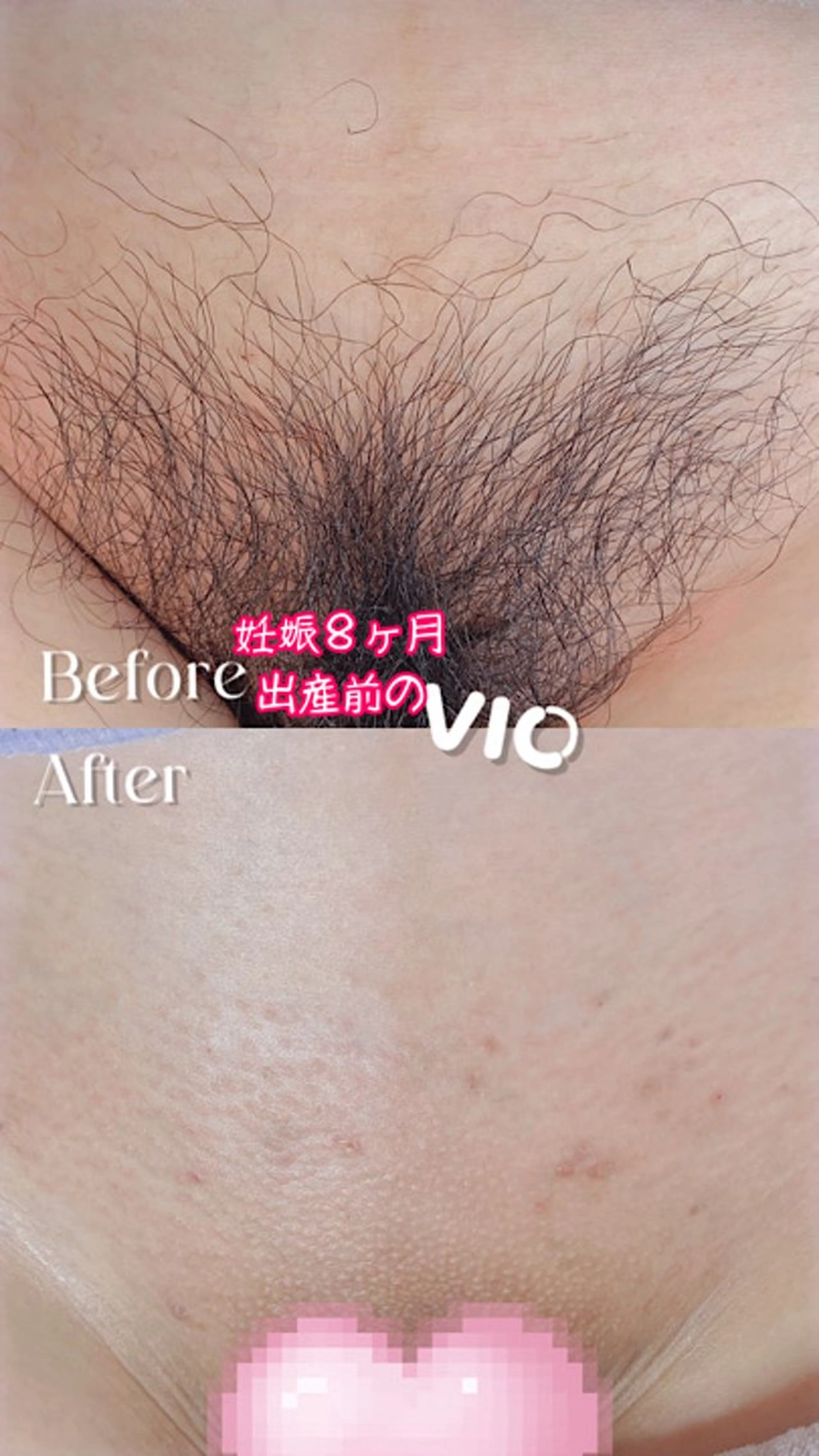 Hitomi シュガーリング豊橋のその他イメージ