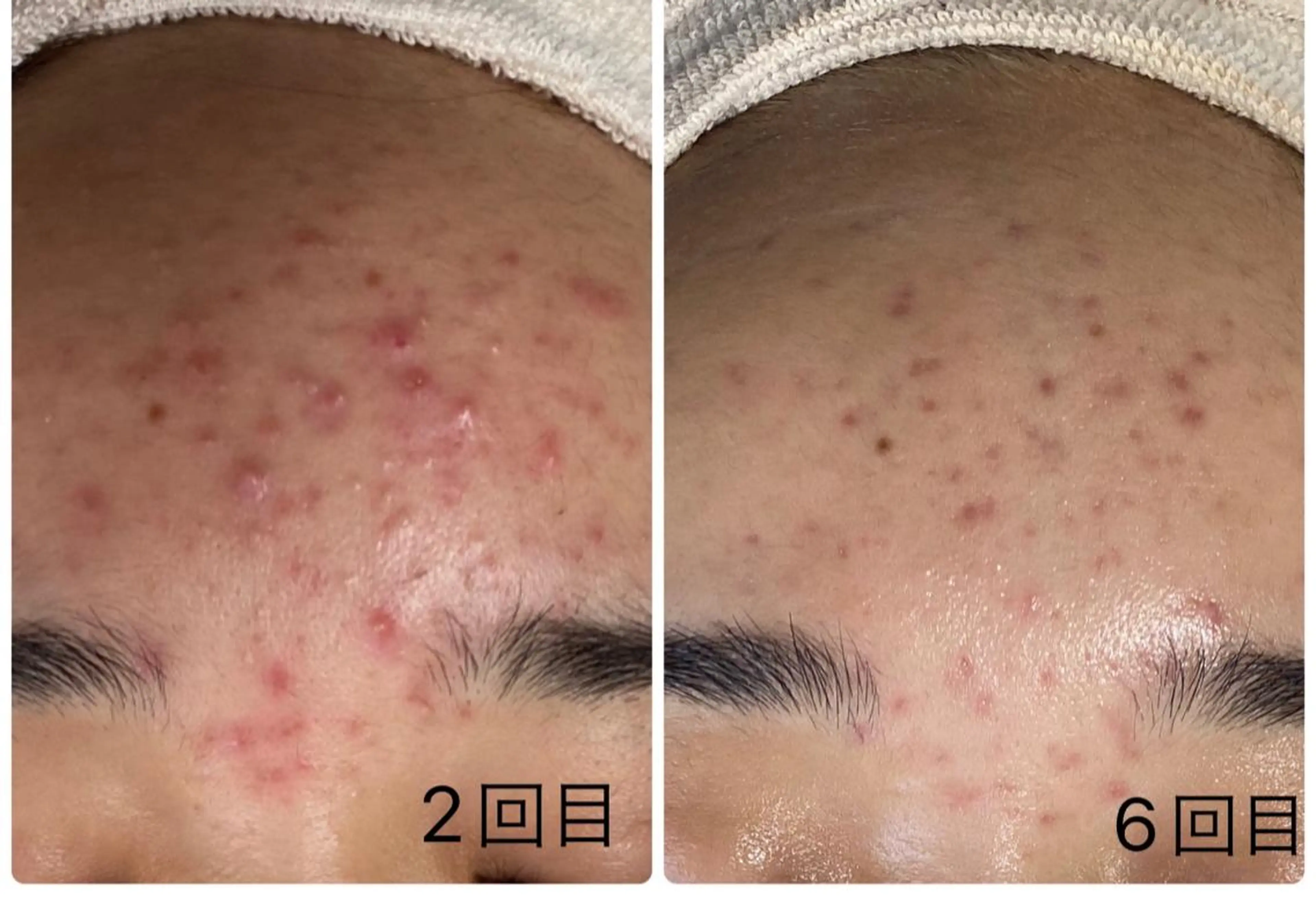 エステ COCO beautyサロンのエステ・リラクイメージ