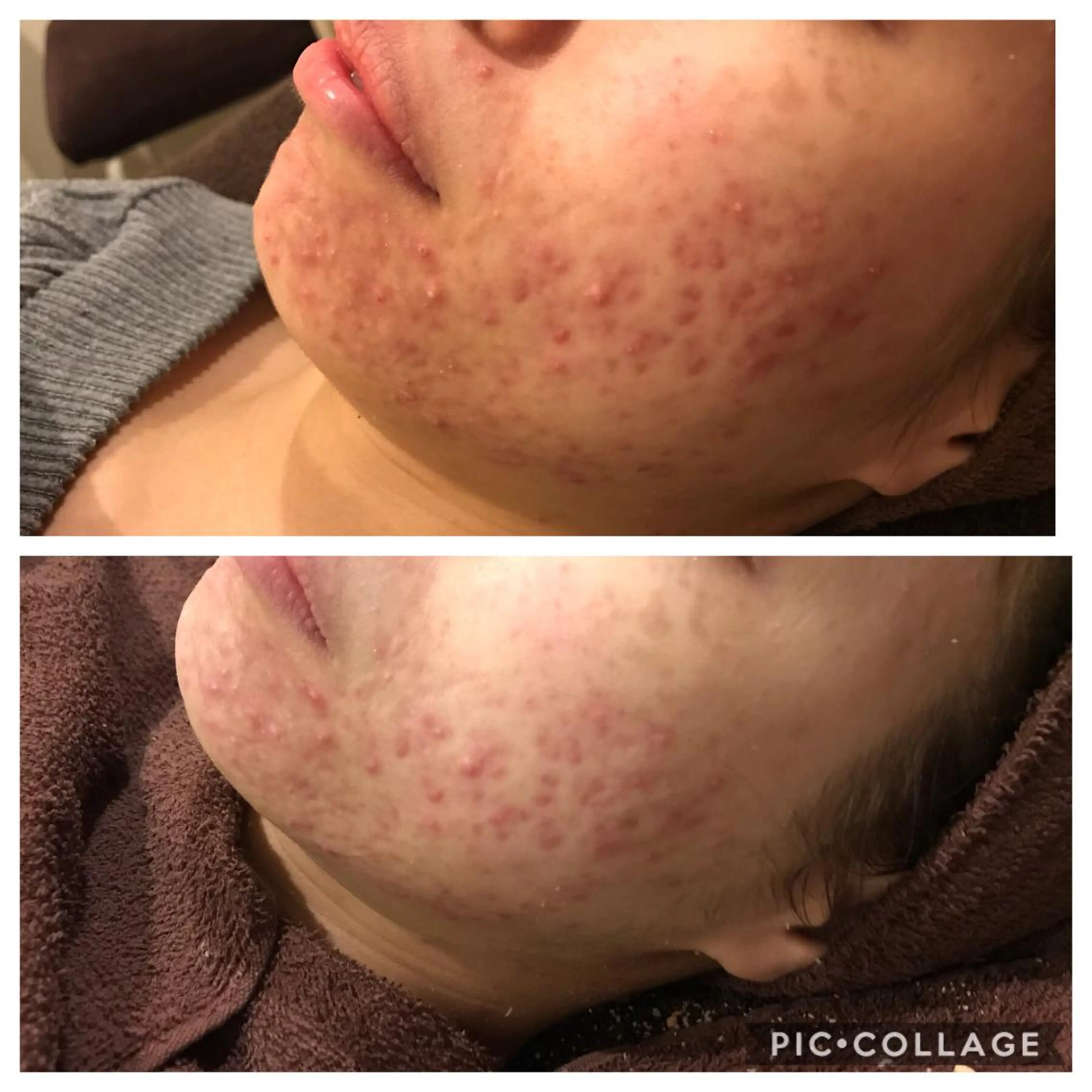 ロング カラー パーマ ヘアアレンジ メンズ キッズ ネイル マツエク・マツパ 金の糸脱毛 産毛ケア専門のエステ・リラクイメージ