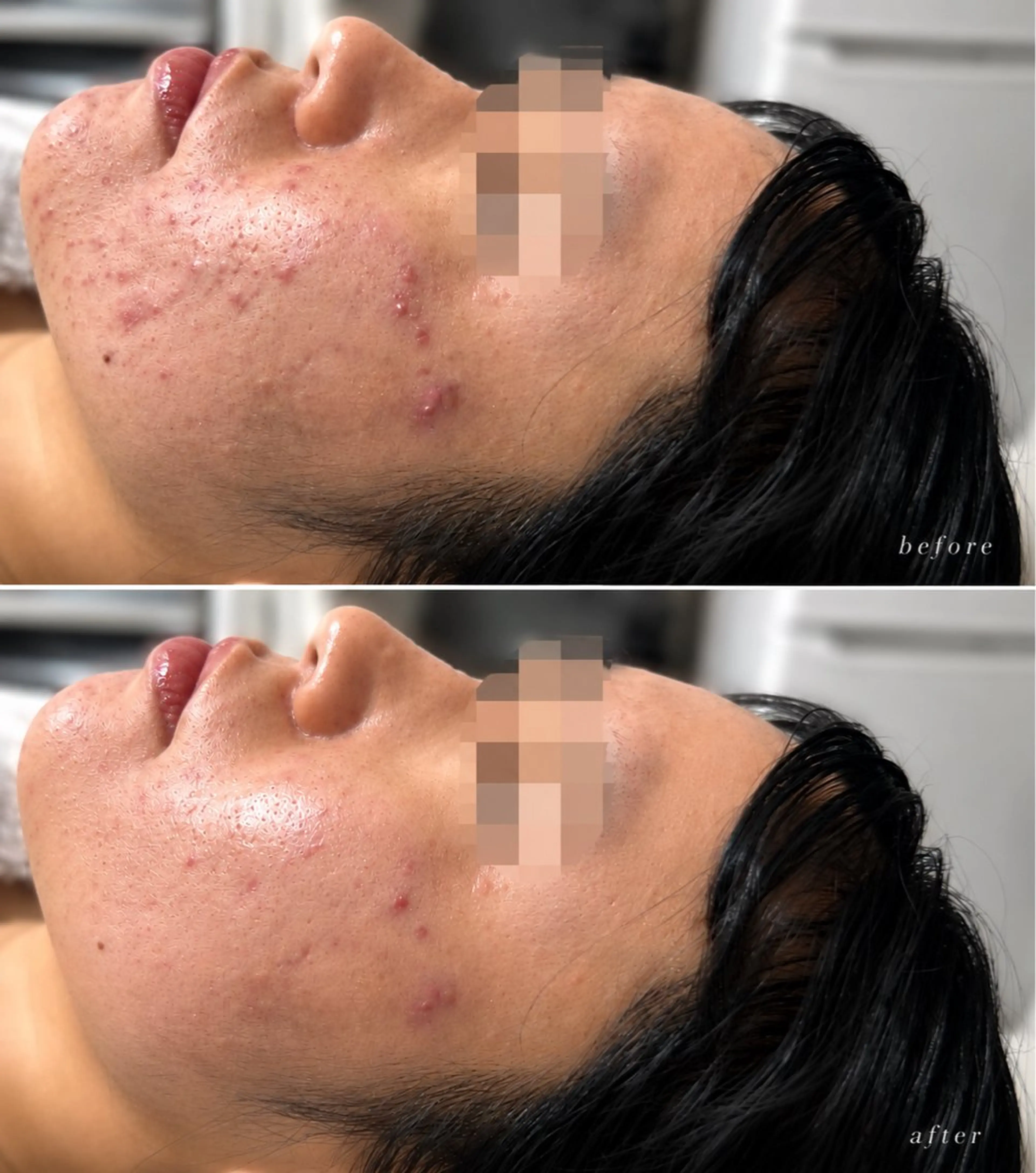 肌質改善サロン salon Aubeのエステ・リラクイメージ