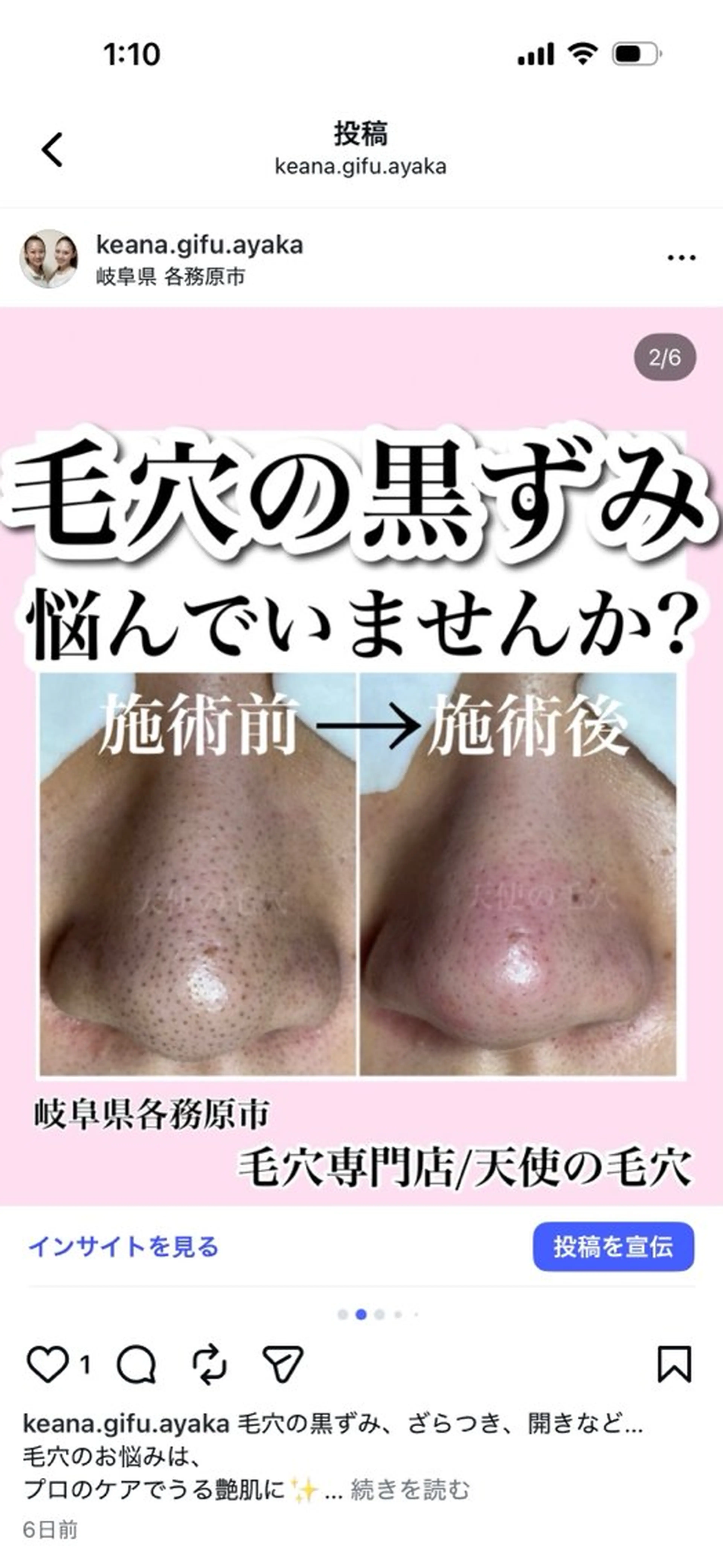 エステ 毛穴専門店【各務原】 天使の毛穴のエステ・リラクイメージ