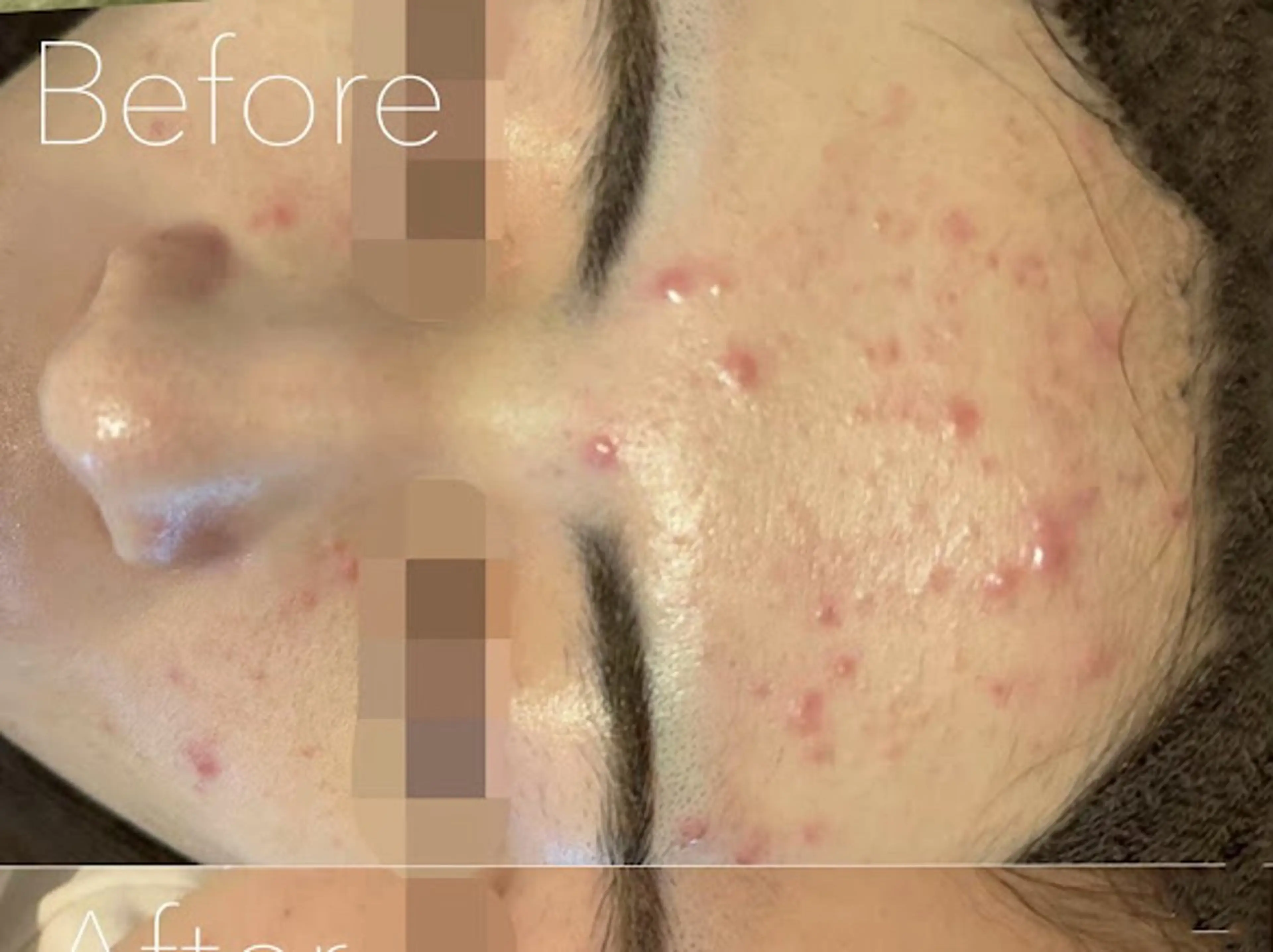 エステ 韓国肌管理Belle 神戸元町のエステ・リラクイメージ