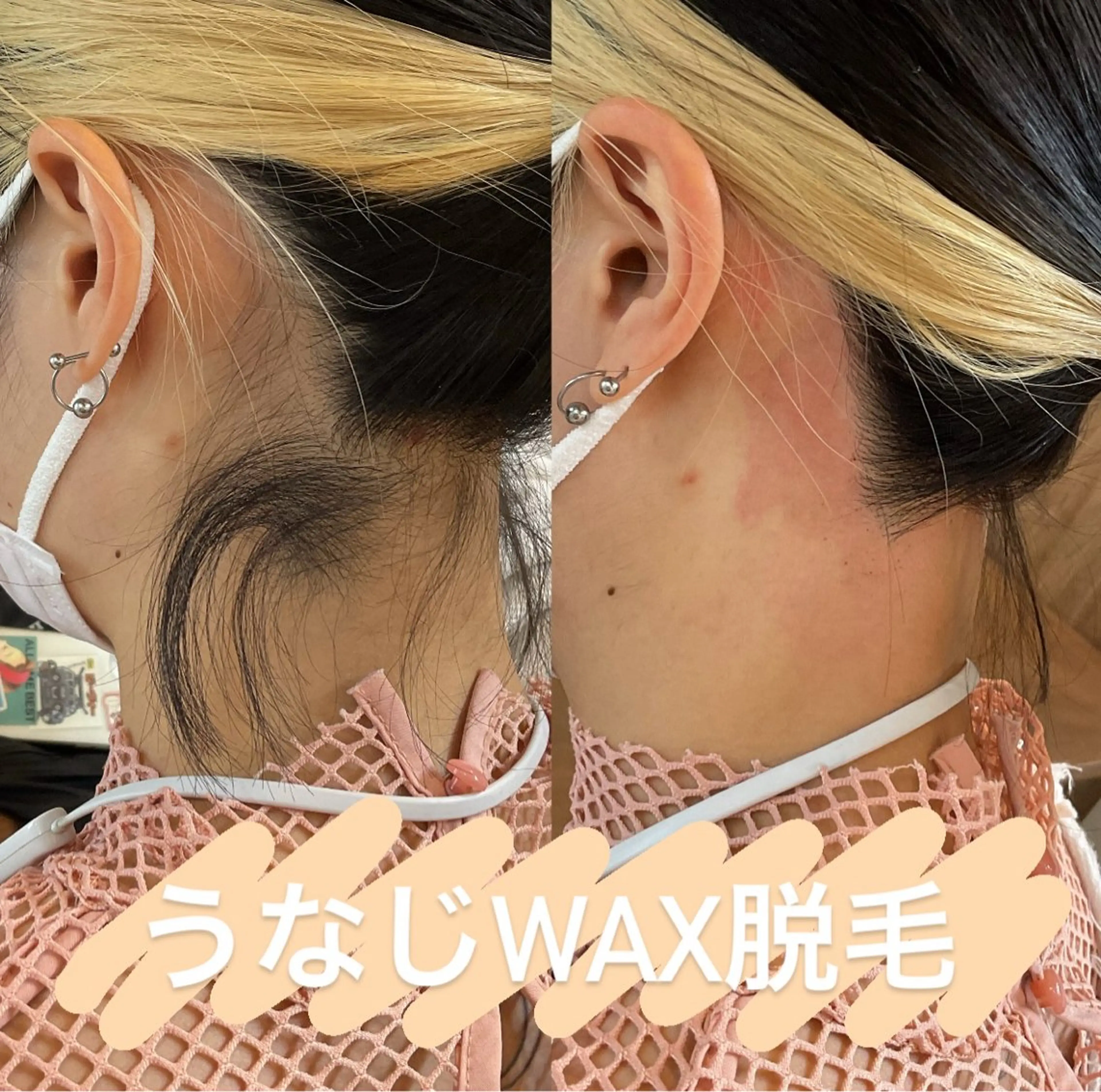 エピナス町田店 ブラジリアンワックスのエステ・リラクイメージ