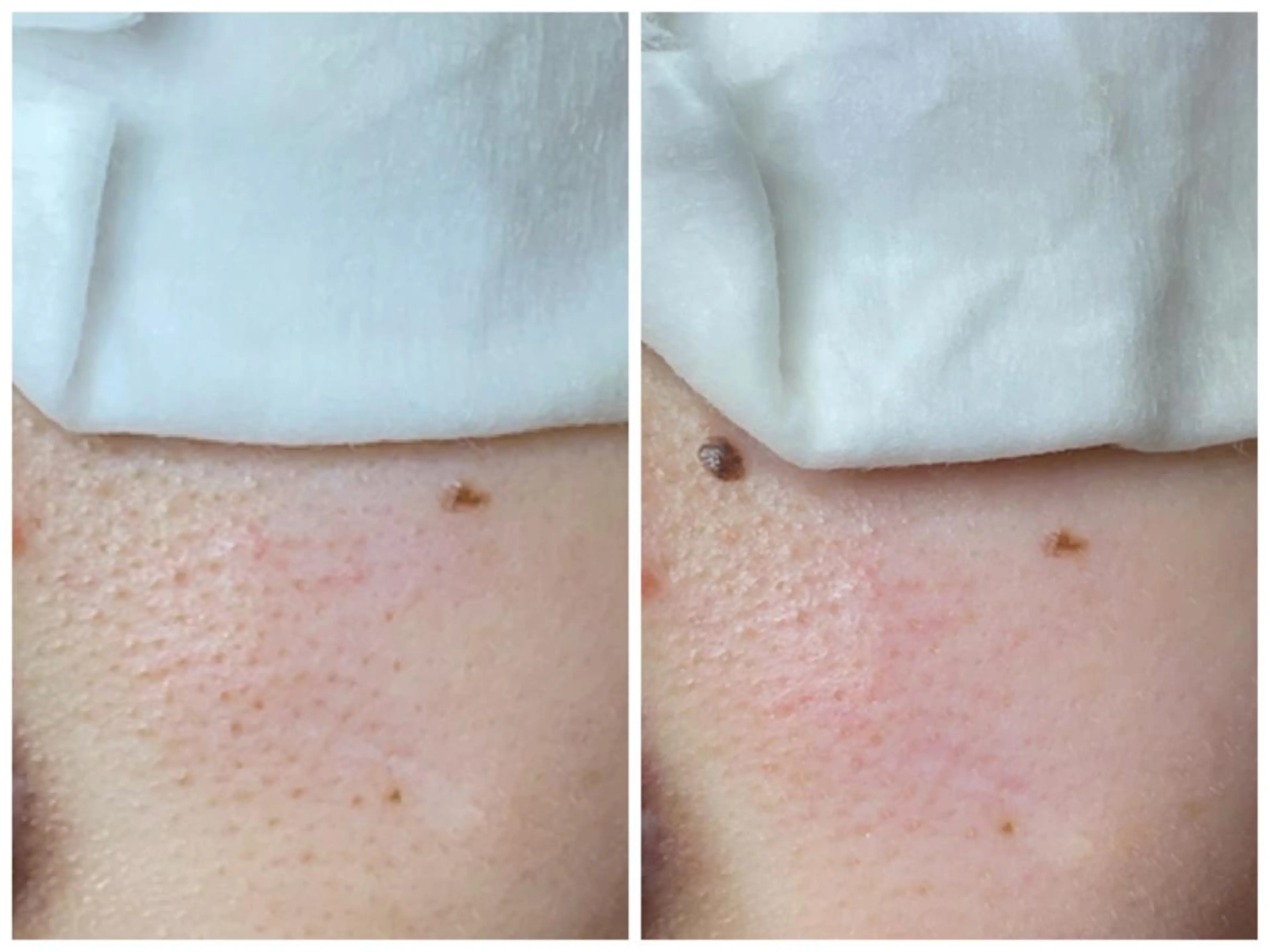 エステ 大久保 里奈のエステ・リラクイメージ