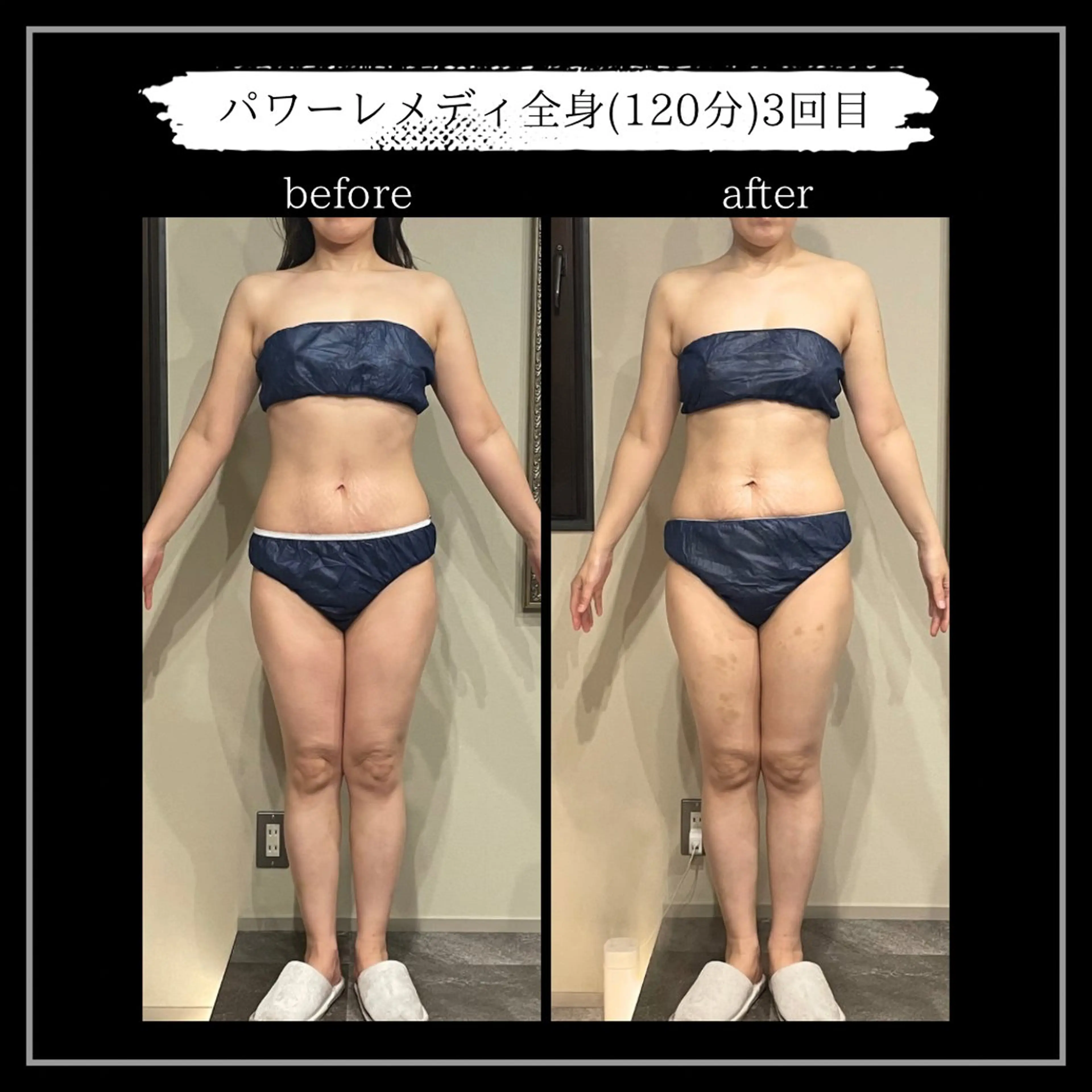 オフ:オン 全身筋膜マッサージのエステ・リラクイメージ