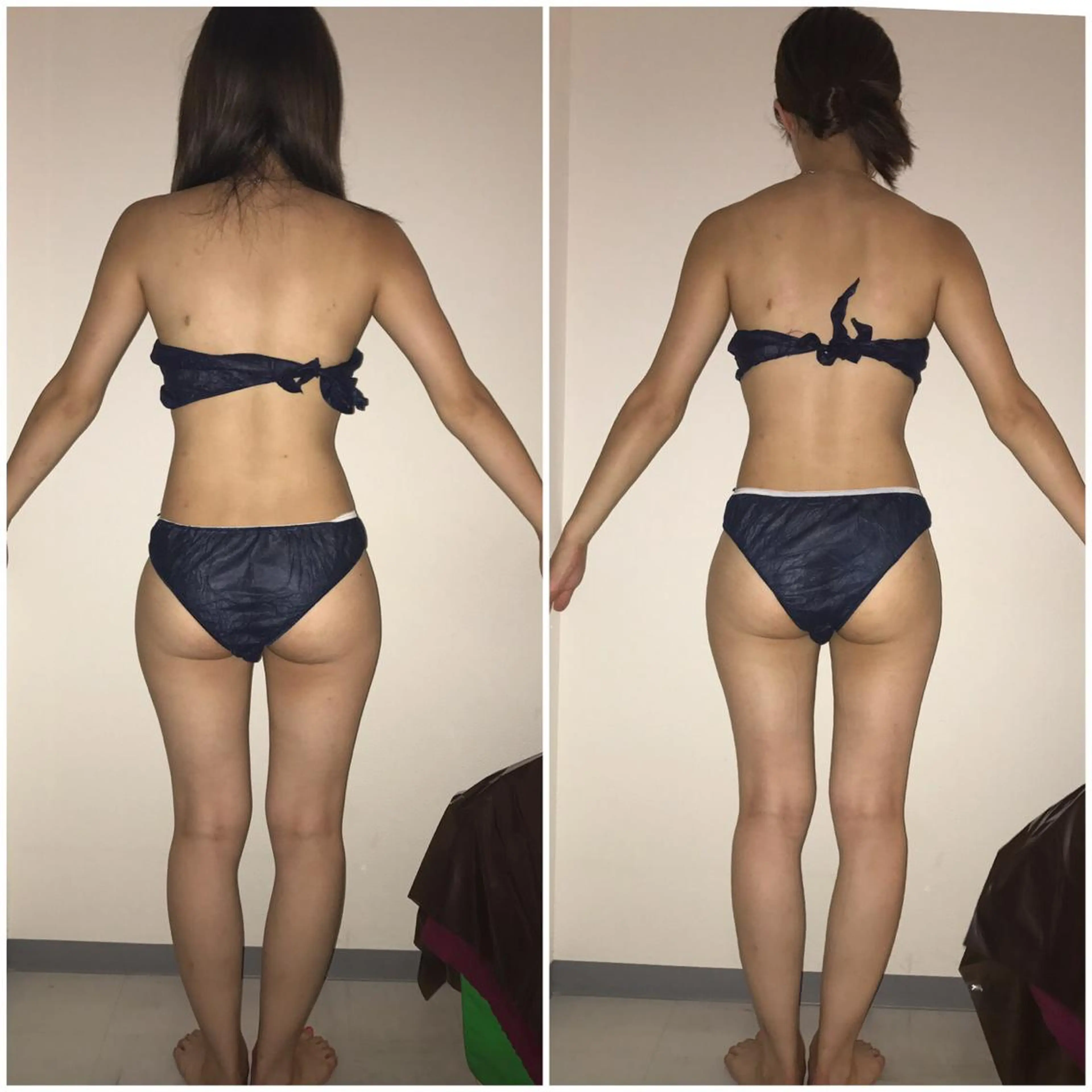 高速脱毛エステ リアンのエステ・リラクイメージ