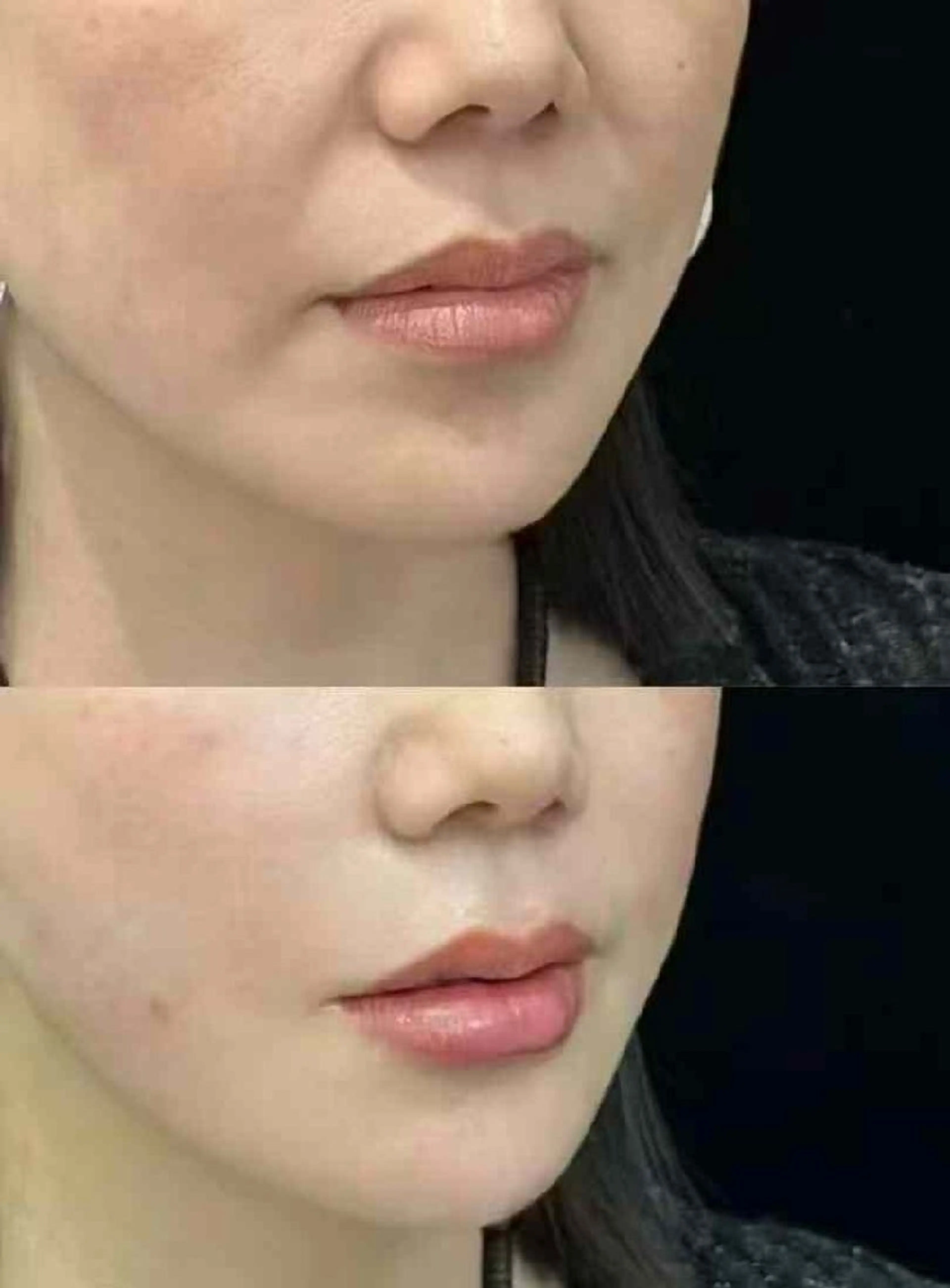 マツエク・マツパ 韓国風マツエク 結婚式・ブライダル aliaハイフ&水光ジェットサロン所属・aliaハーブ水光店 エステティシャン募集のエステ・リラクイメージ