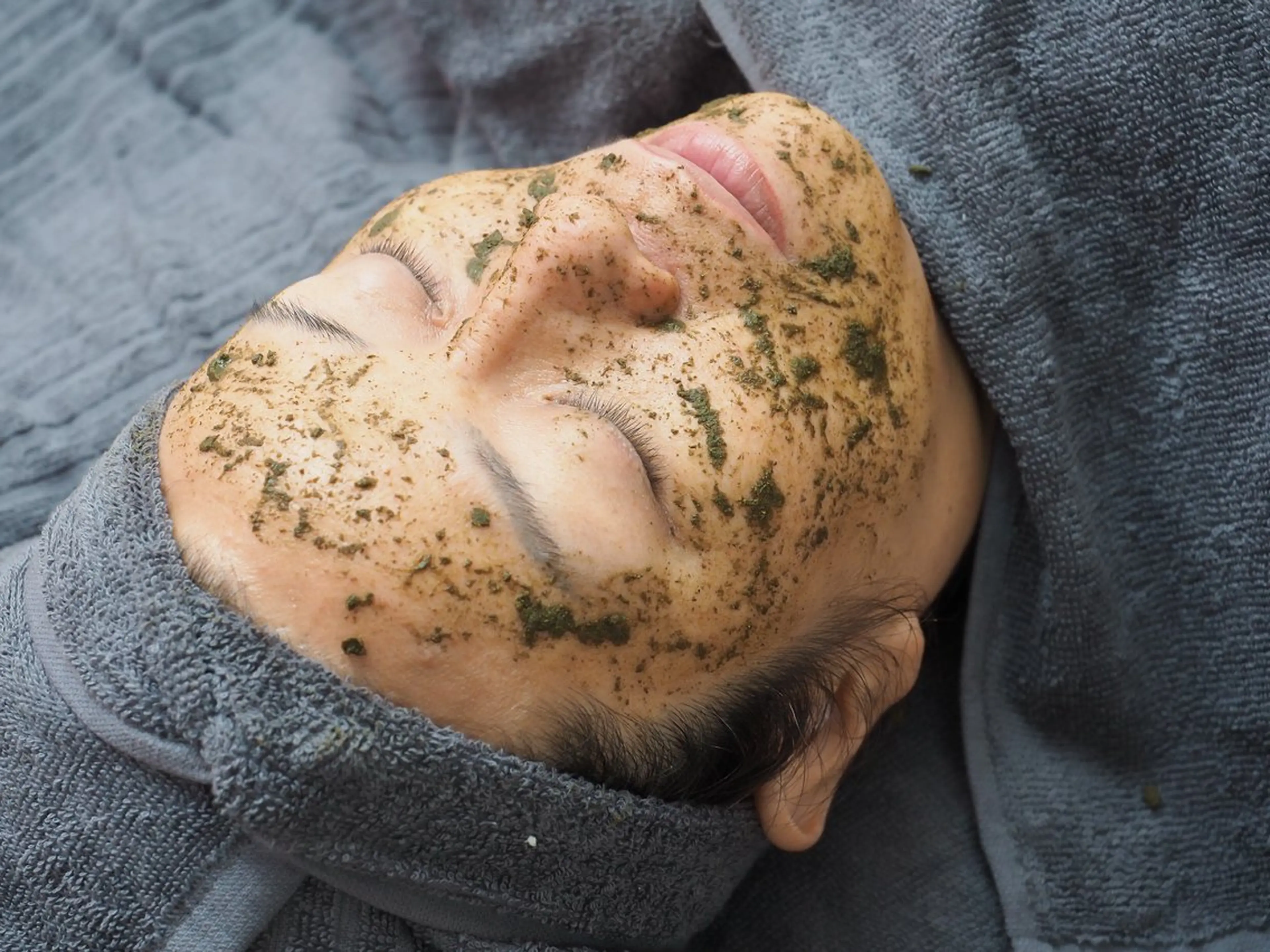 【剥離なし植物幹細胞】毛穴洗浄＋ハーブピーリングコース　¥12,000の写真