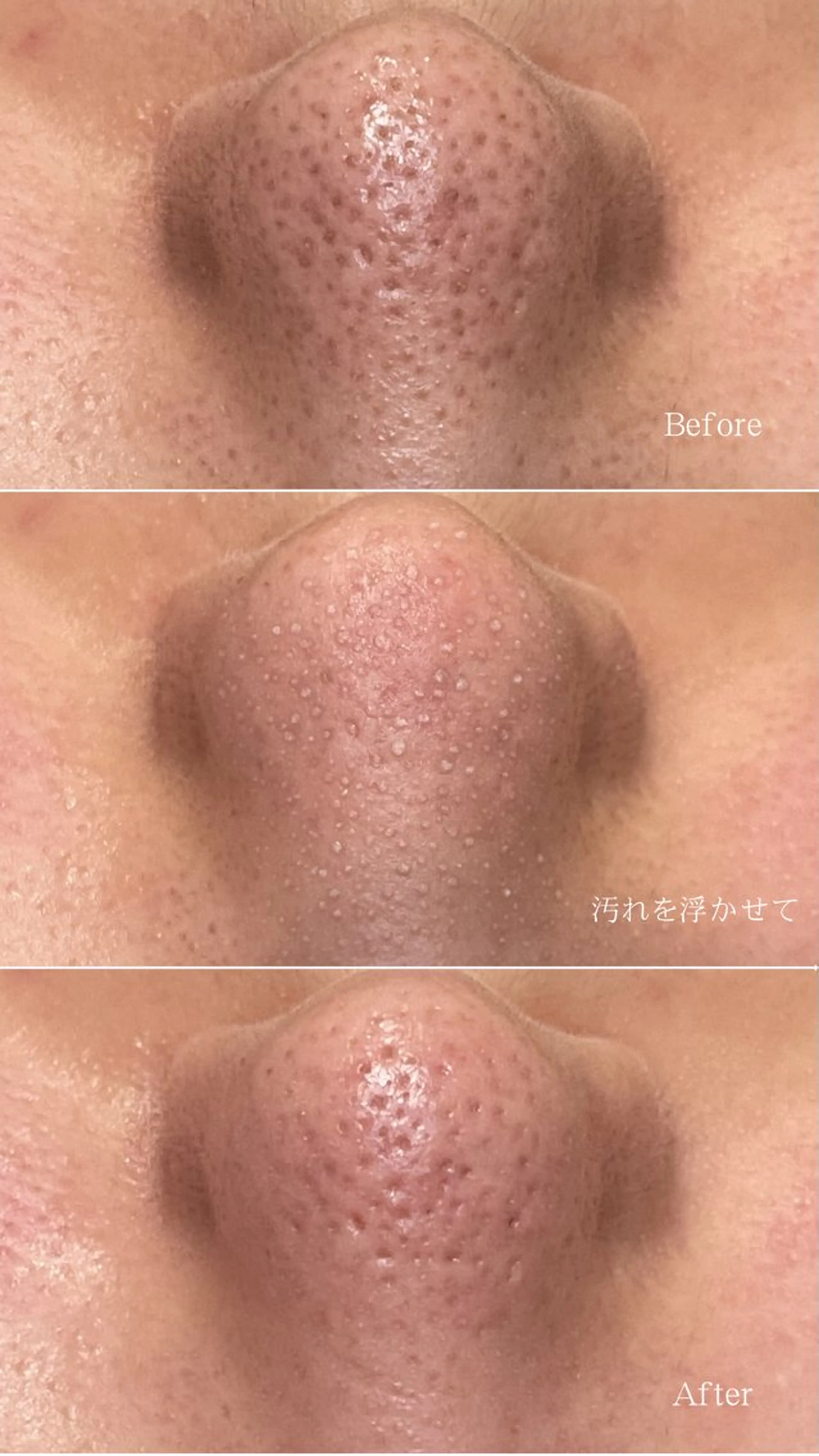 メンズ エステ 新宿大久保美容サロン BELL  マイのその他イメージ