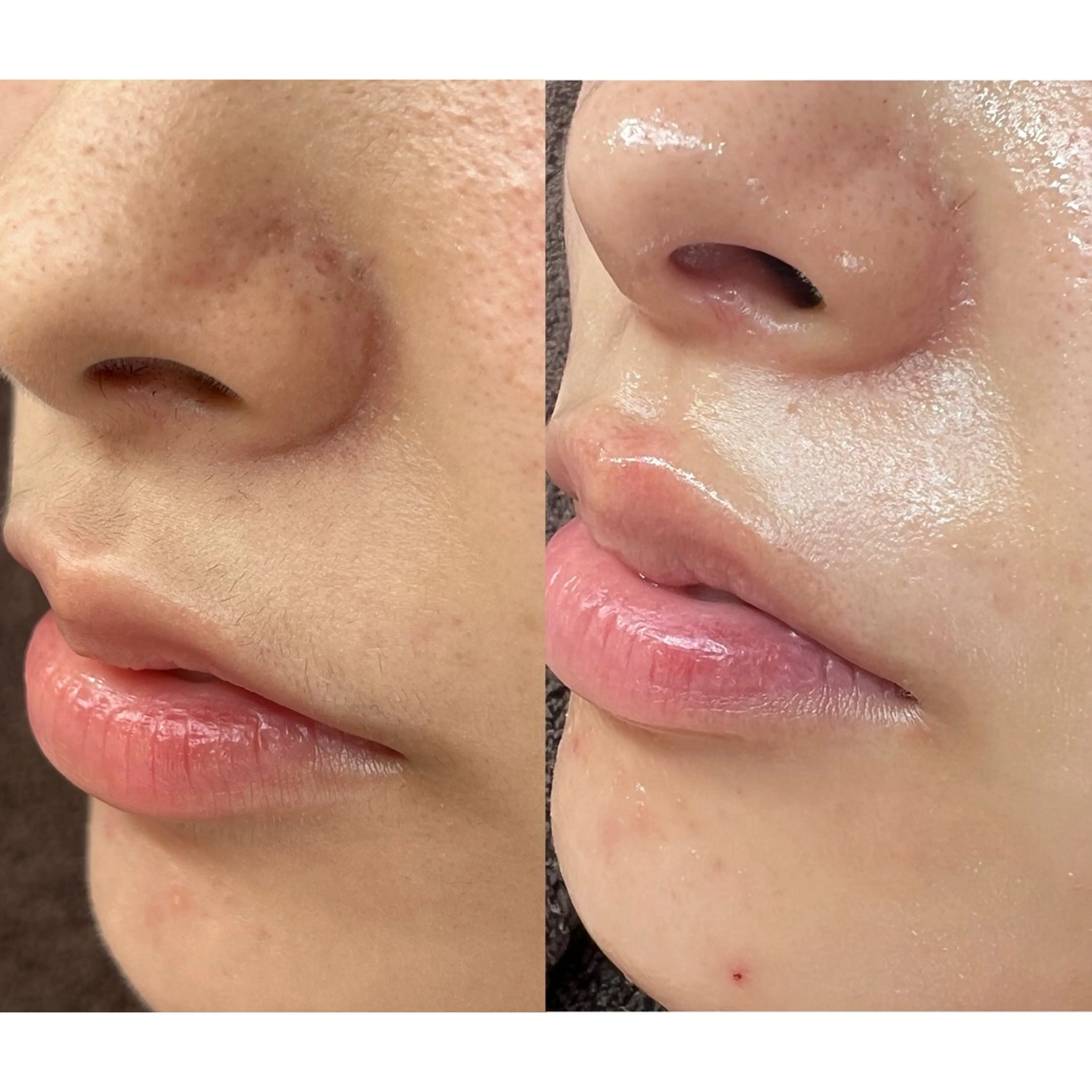 Cheri所属・丸山 彩乃のエステ・リラクイメージ