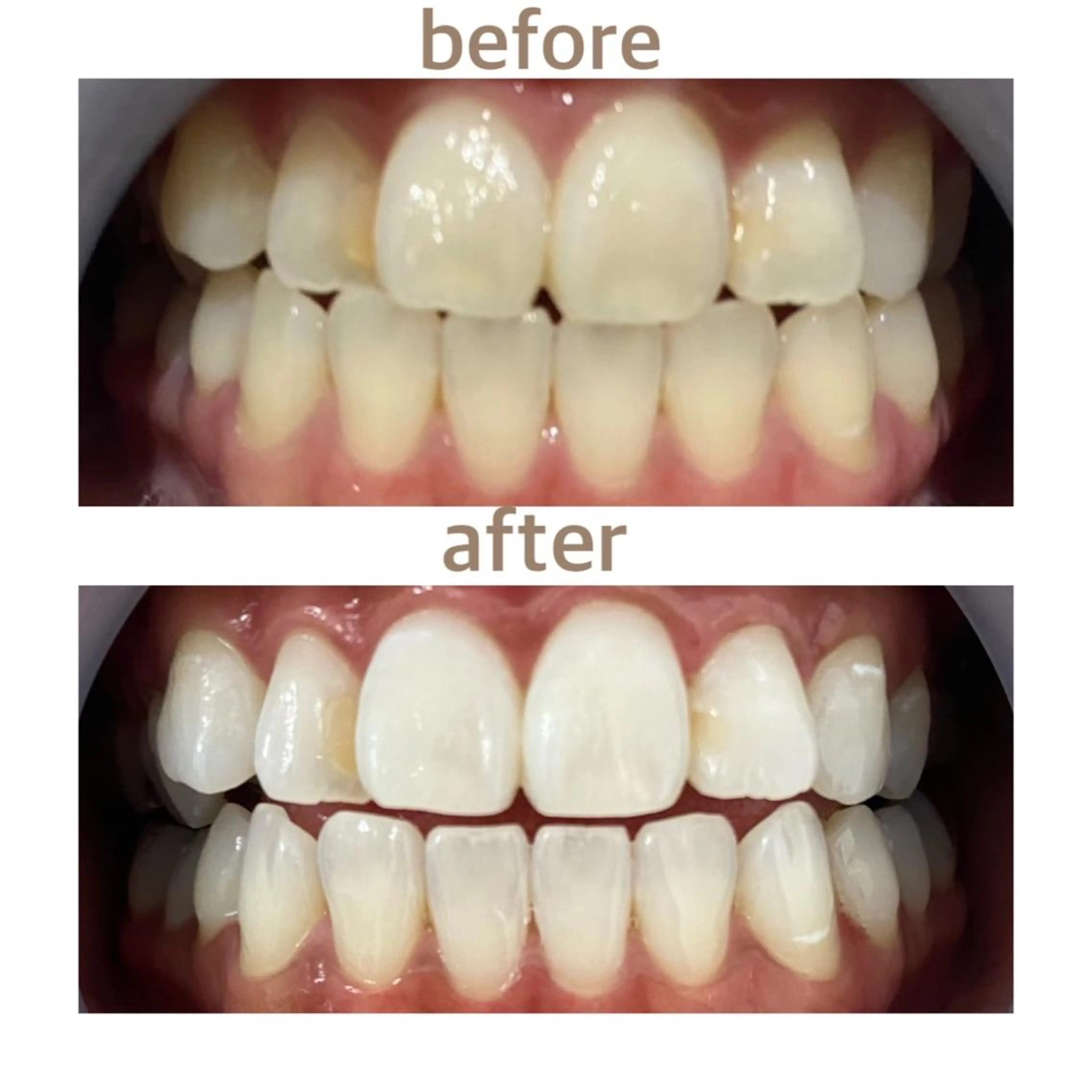 メンズ エステ リラク ホワイトニング ショップ船橋２号店のエステ・リラクイメージ