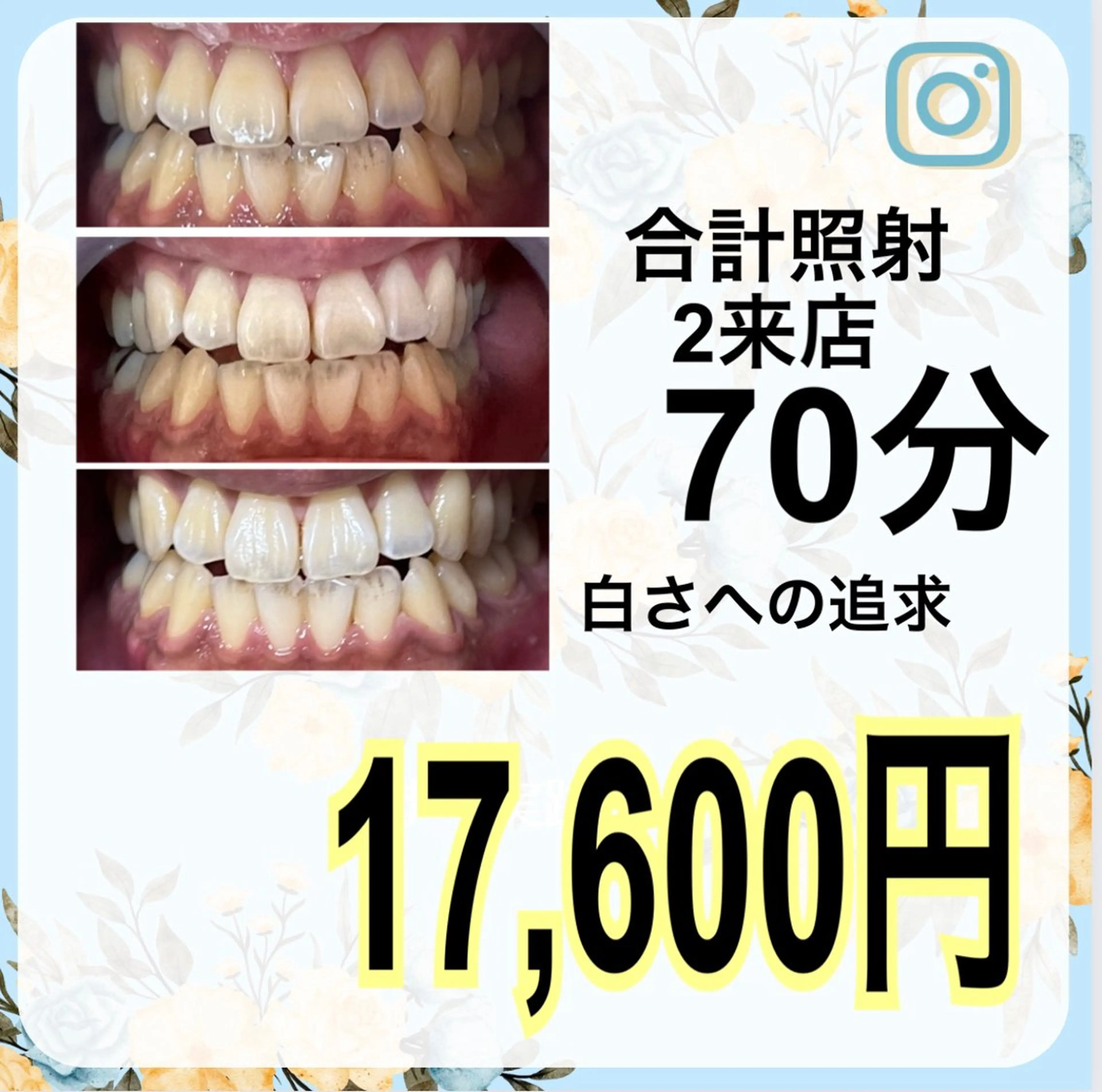 その他 ライトビューティー 渋谷本店のその他イメージ