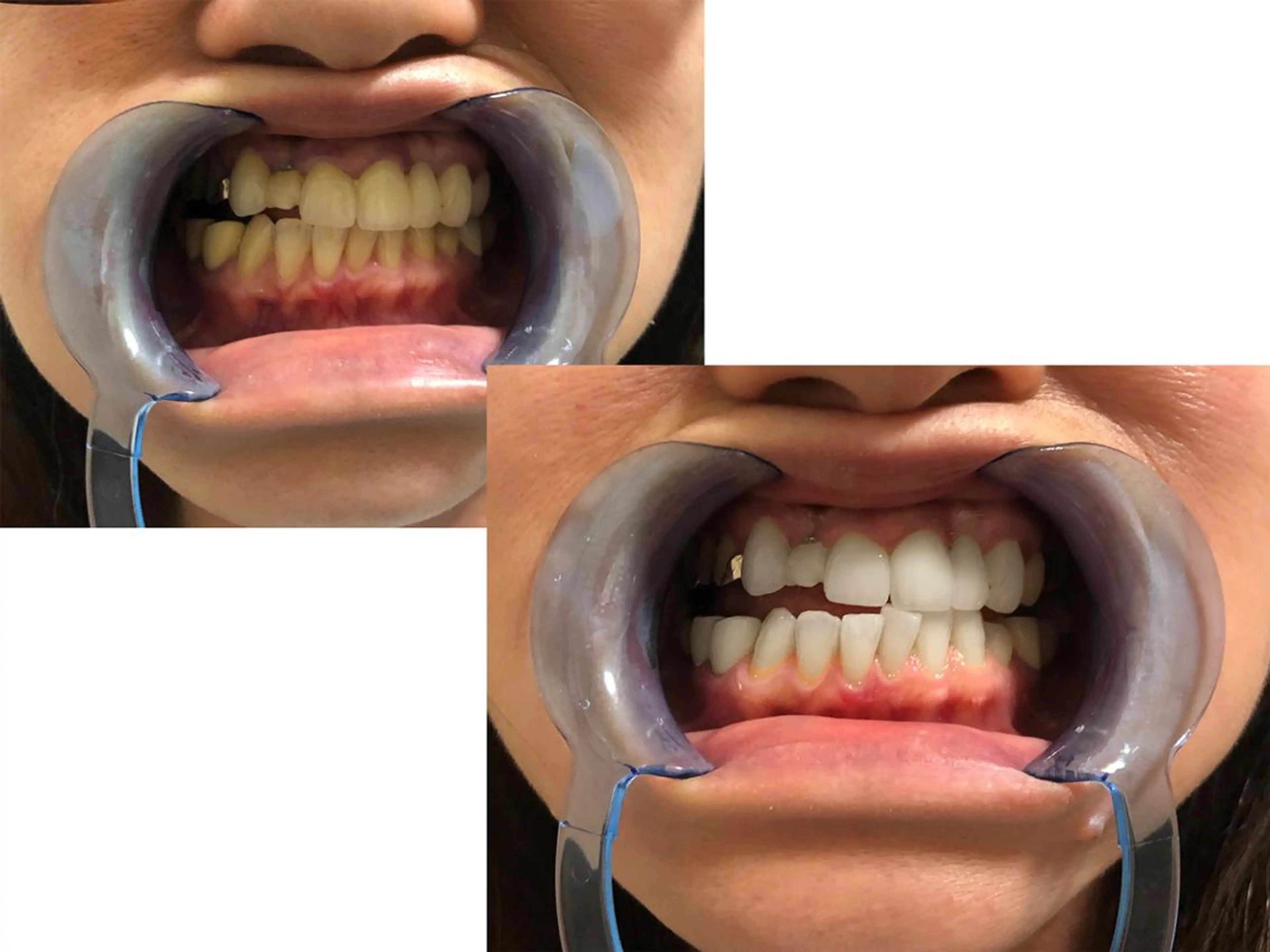 カラー キッズ ショート パーマ ヘアアレンジ マツエク・マツパ メンズ アイブロウ ネイル 結婚式・ブライダル 結婚式・ブライダル 赤色 ブライダルネイル ホワイト 中目黒 ホワイトニングサロンのその他イメージ