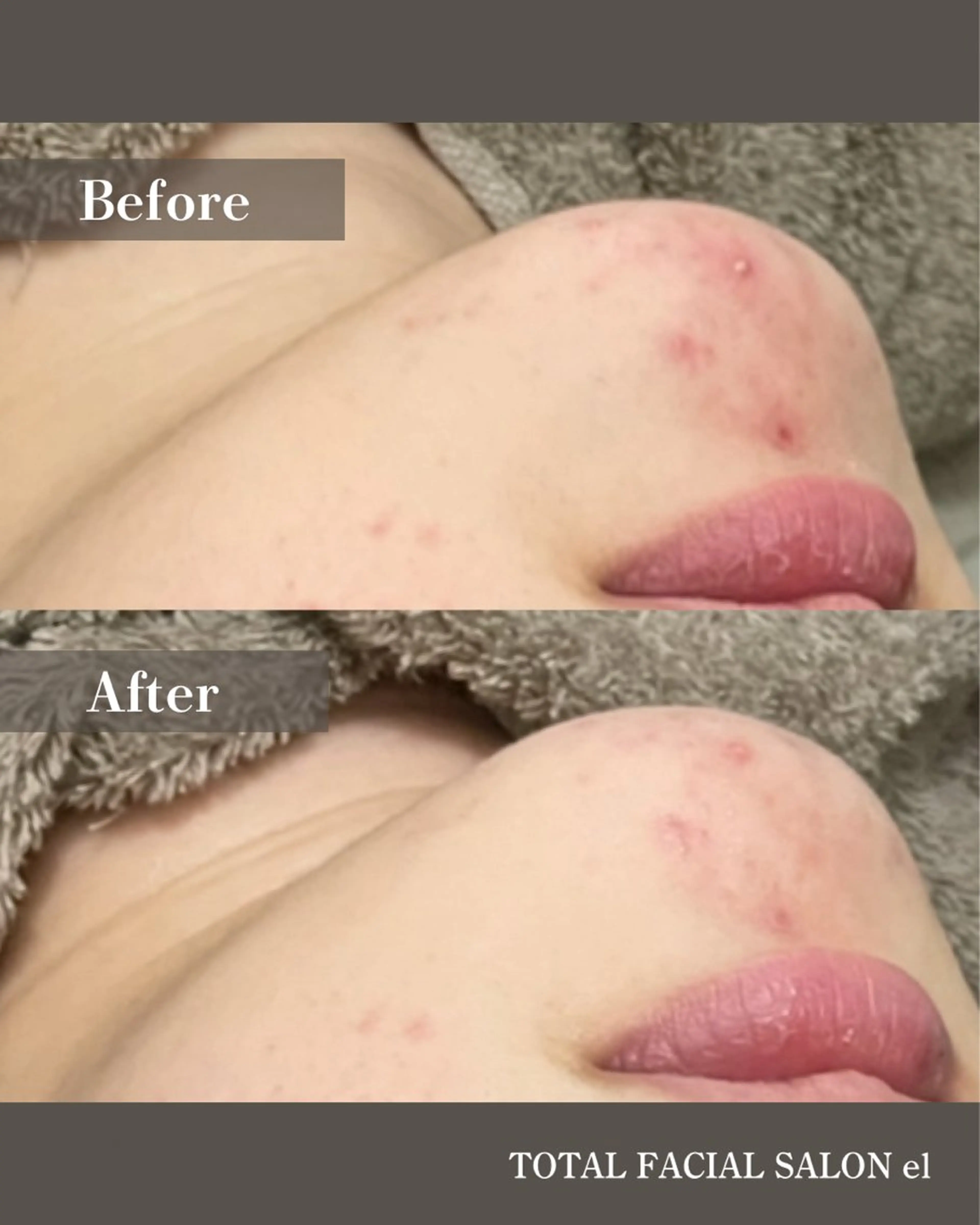 エステ SALON el KARINのエステ・リラクイメージ