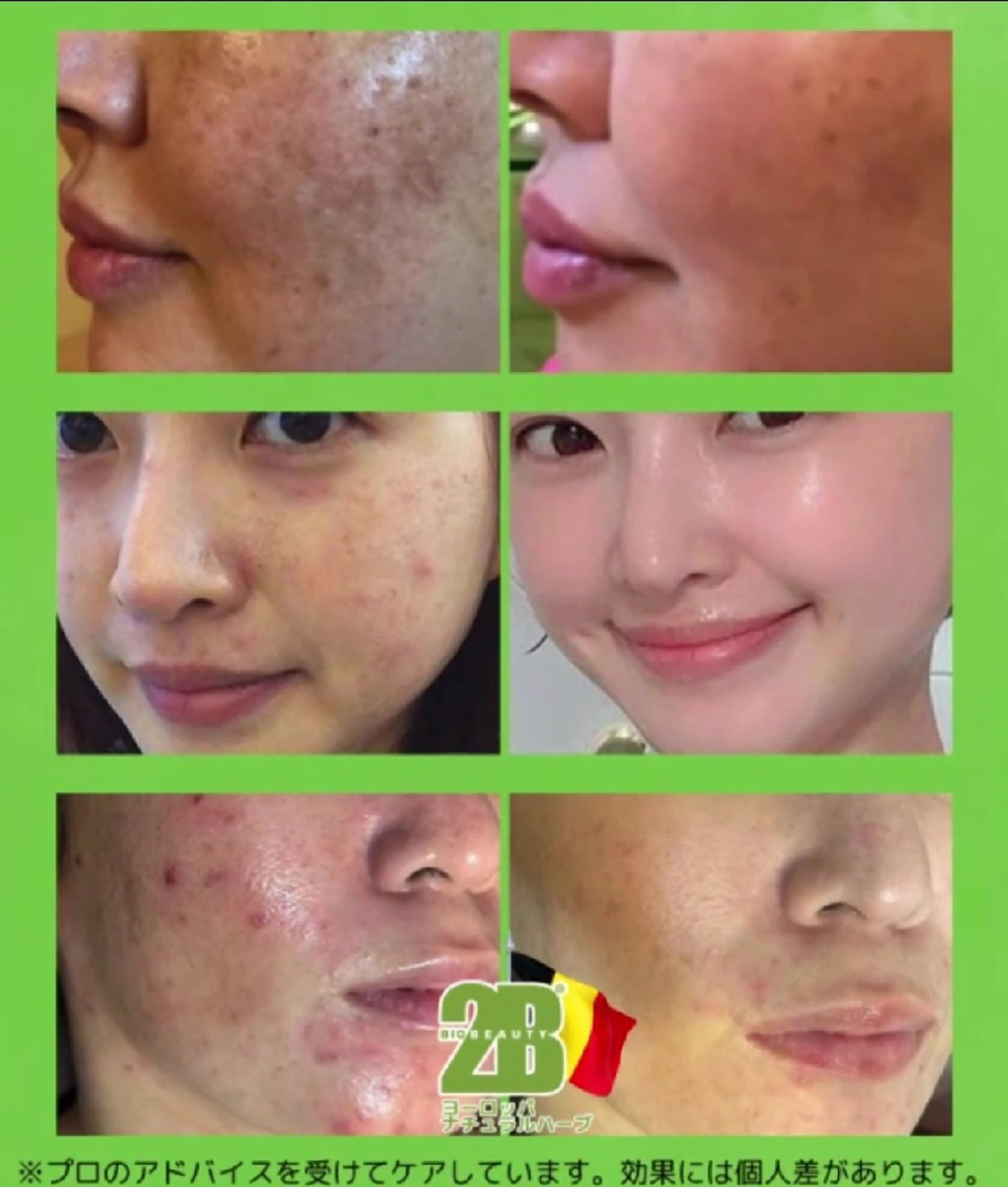 Arebeau 健康的にダイエットのエステ・リラクイメージ