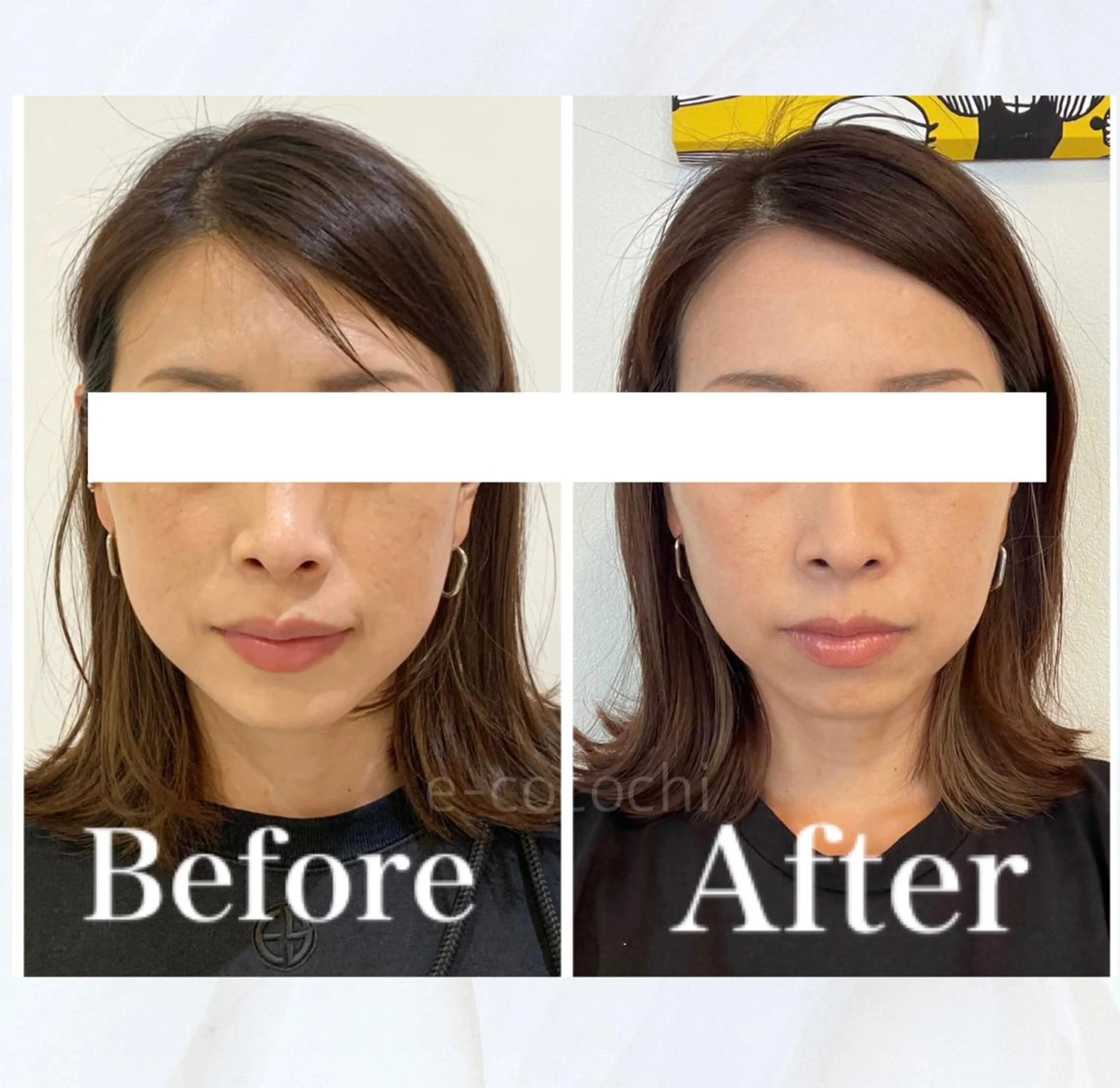 エステ リラク 小顔と ヘッドスパのお店のエステ・リラクイメージ