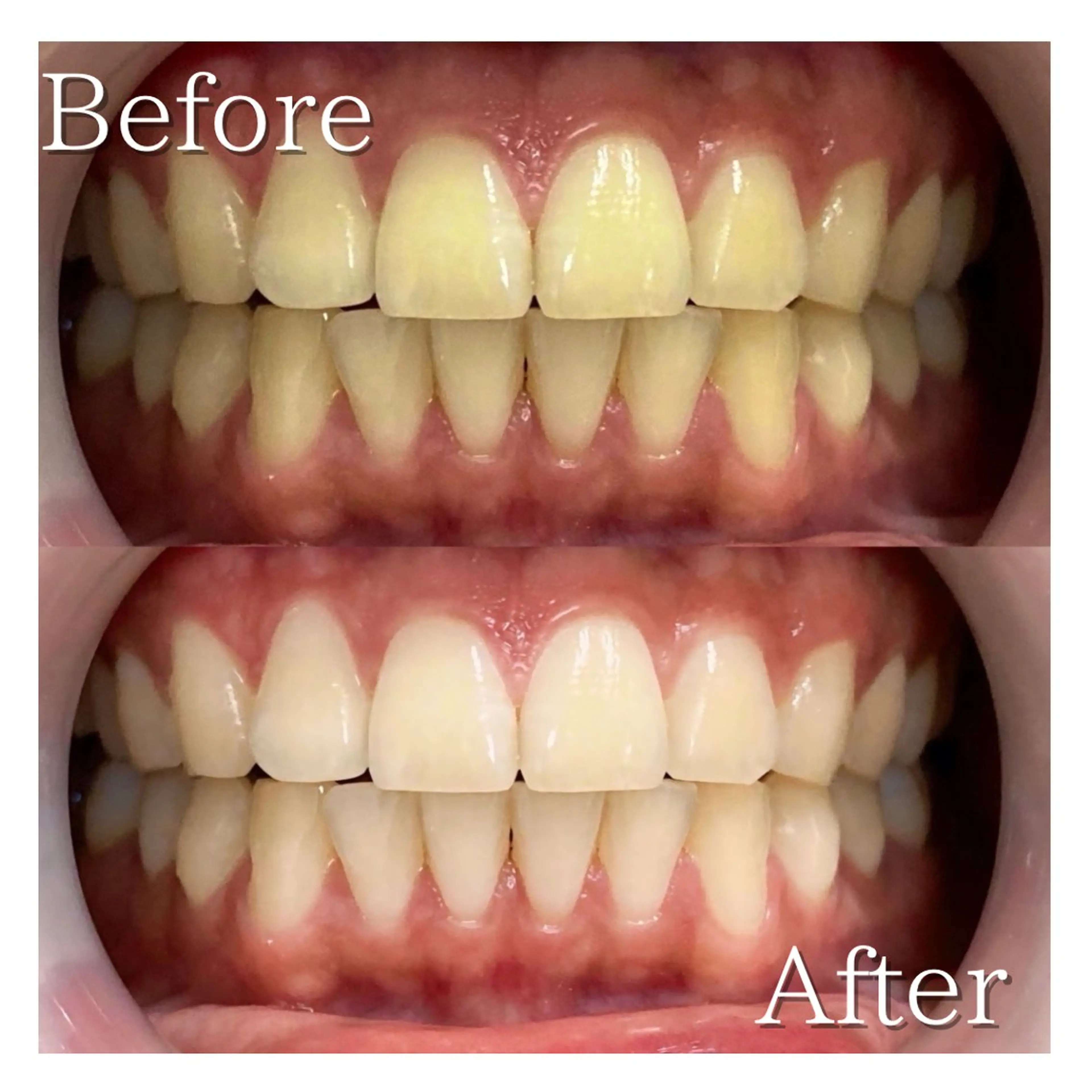 ショート LBSホワイトニング 🌐岡山店のその他イメージ