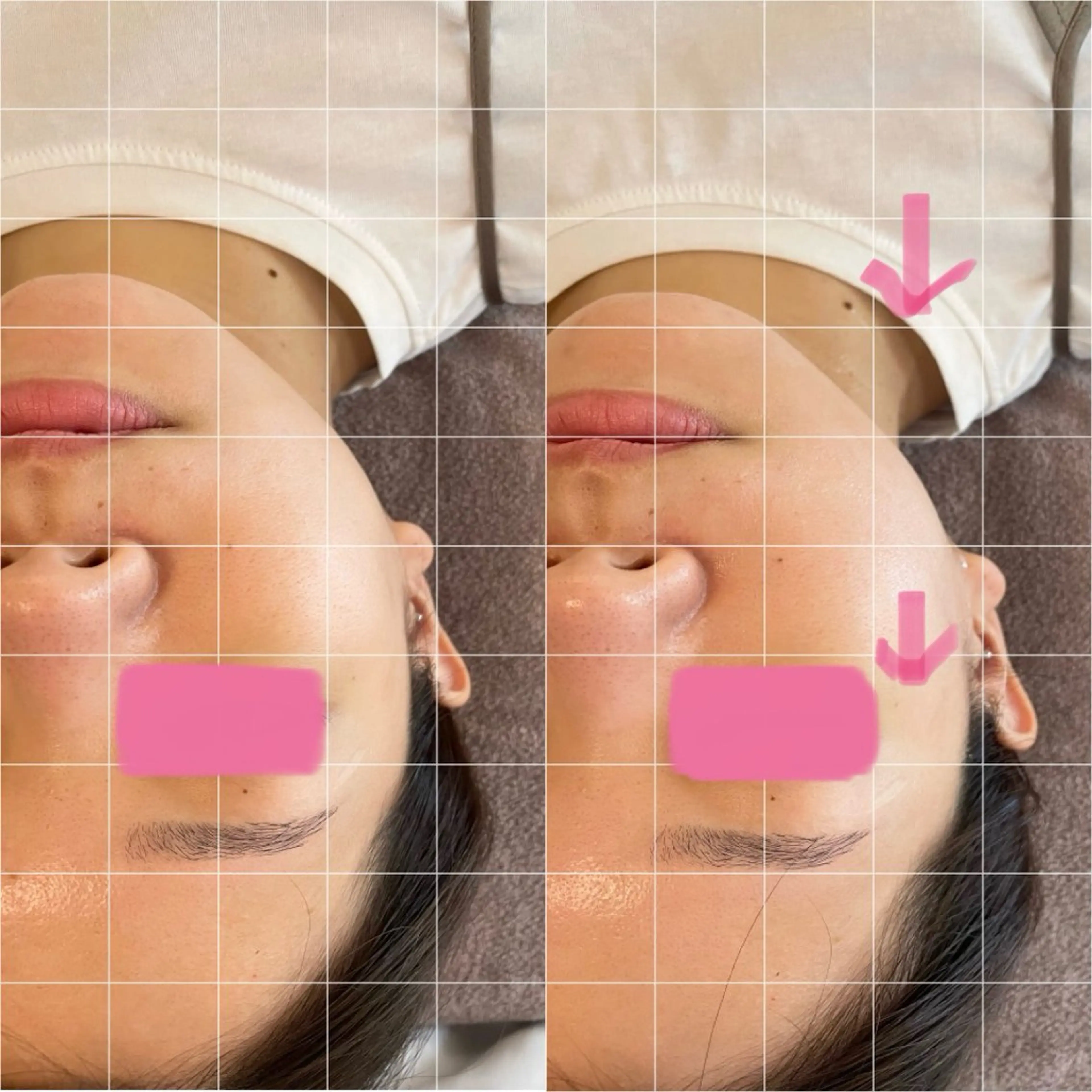 小顔とシミケア🪽 /Salon Mのエステ・リラクイメージ