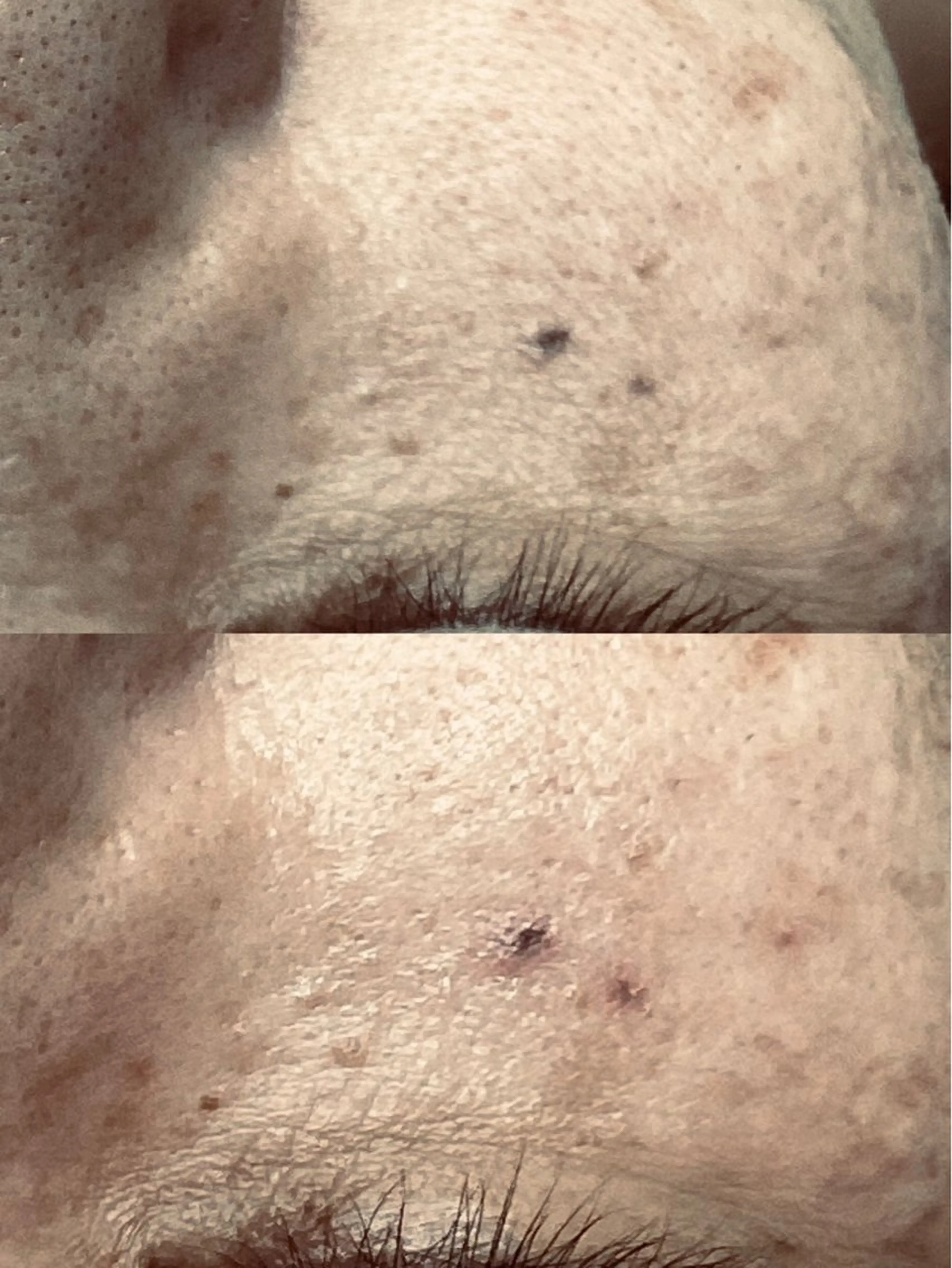 その他 最新美肌脱毛 韓国水光肌🫧のその他イメージ