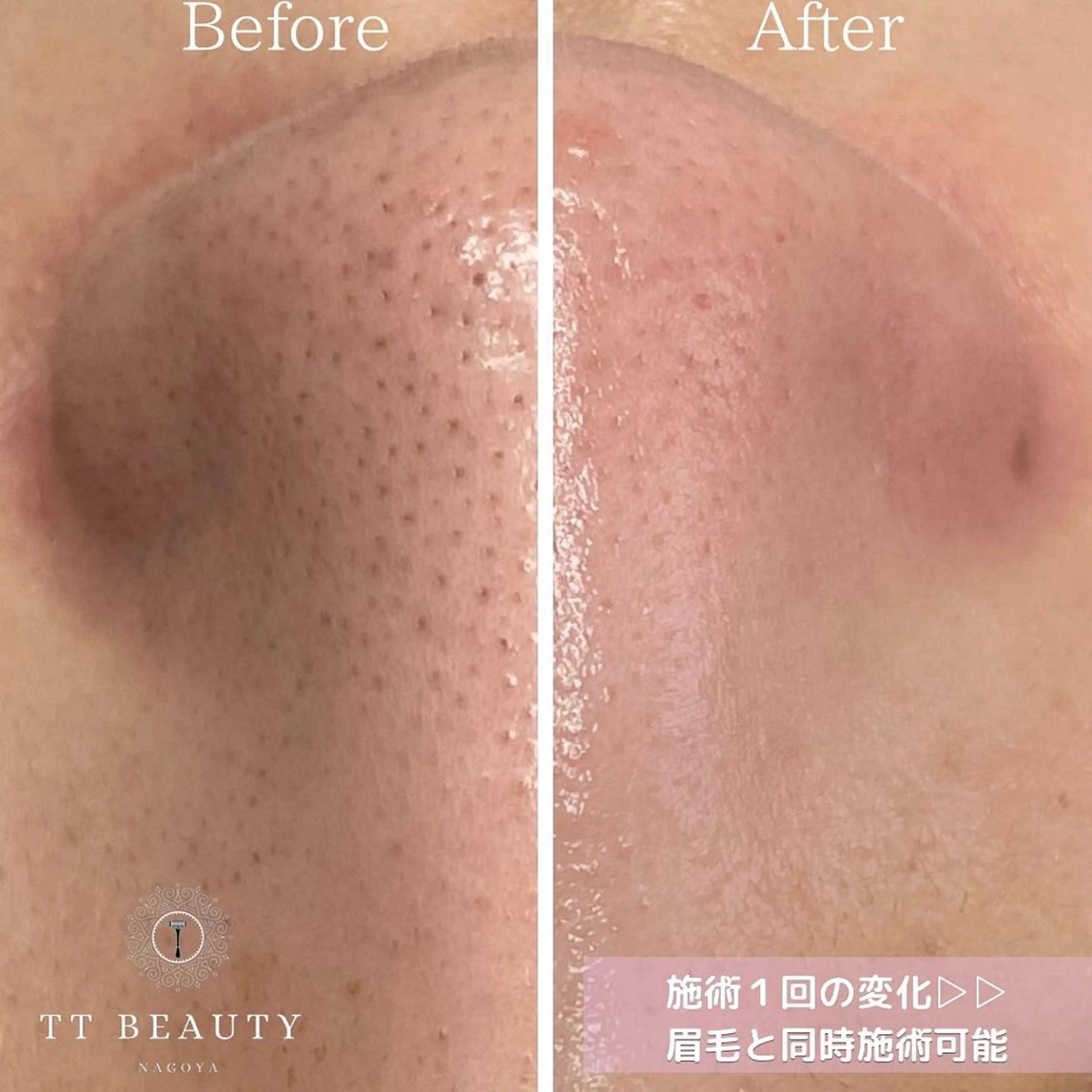 アイブロウ TT Beautyの眉毛・アイブロウイメージ