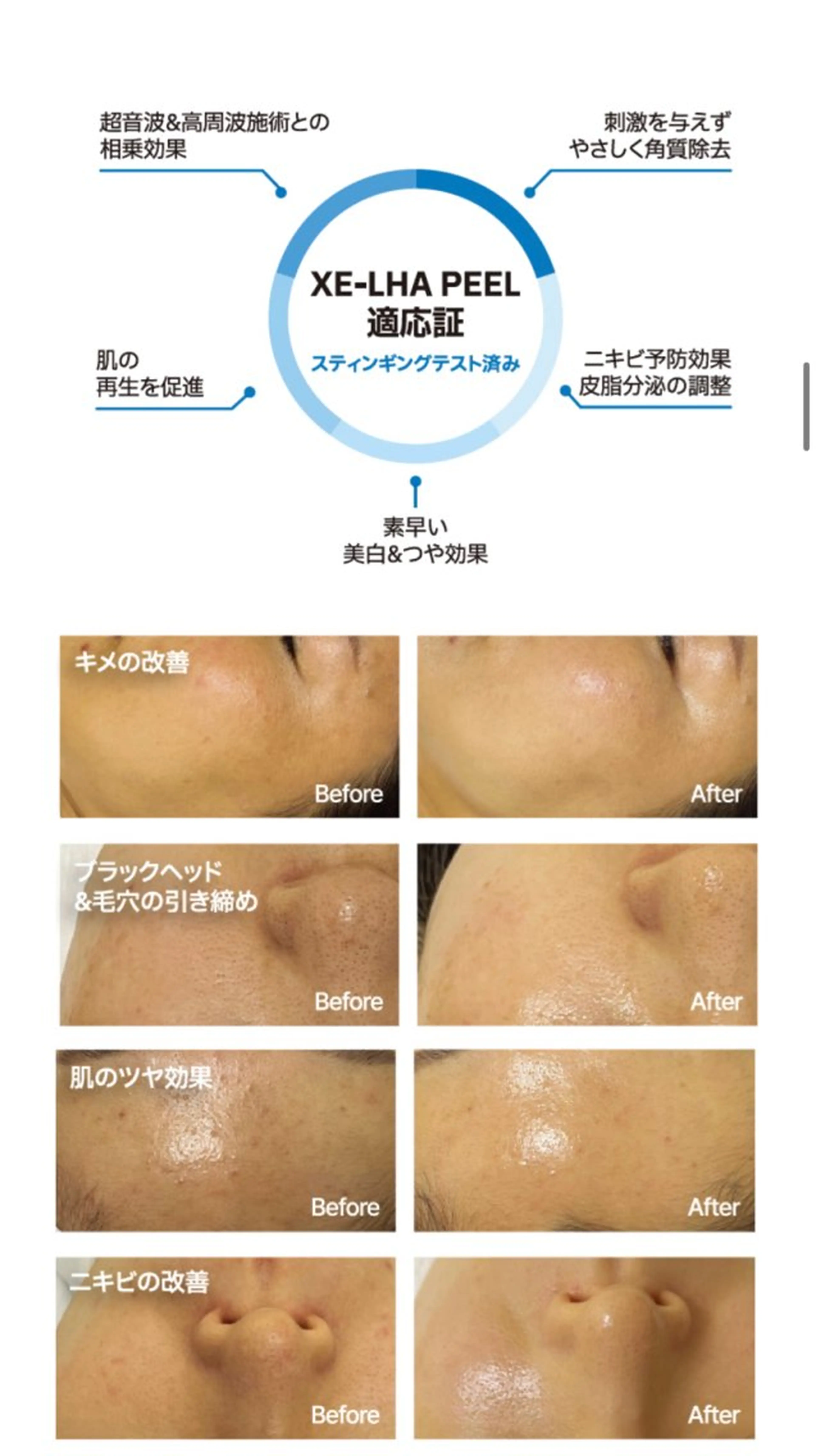 レティティア【Laetitia】所属・レティティア秋葉原店 Yoshizawaのエステ・リラクイメージ