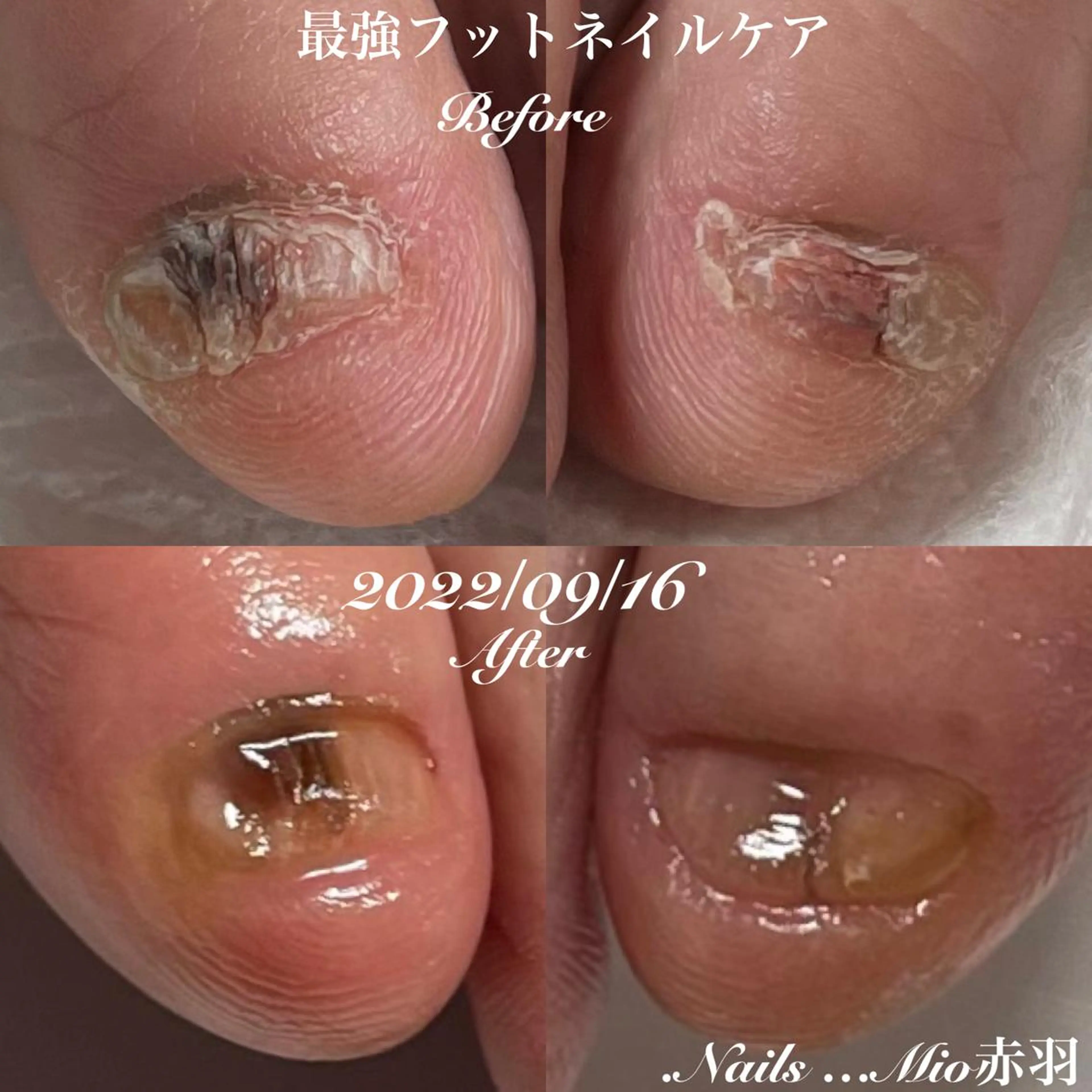 ネイル フットネイル フットネイル .Nails Mio 赤羽西ネイルサロンのネイルデザイン