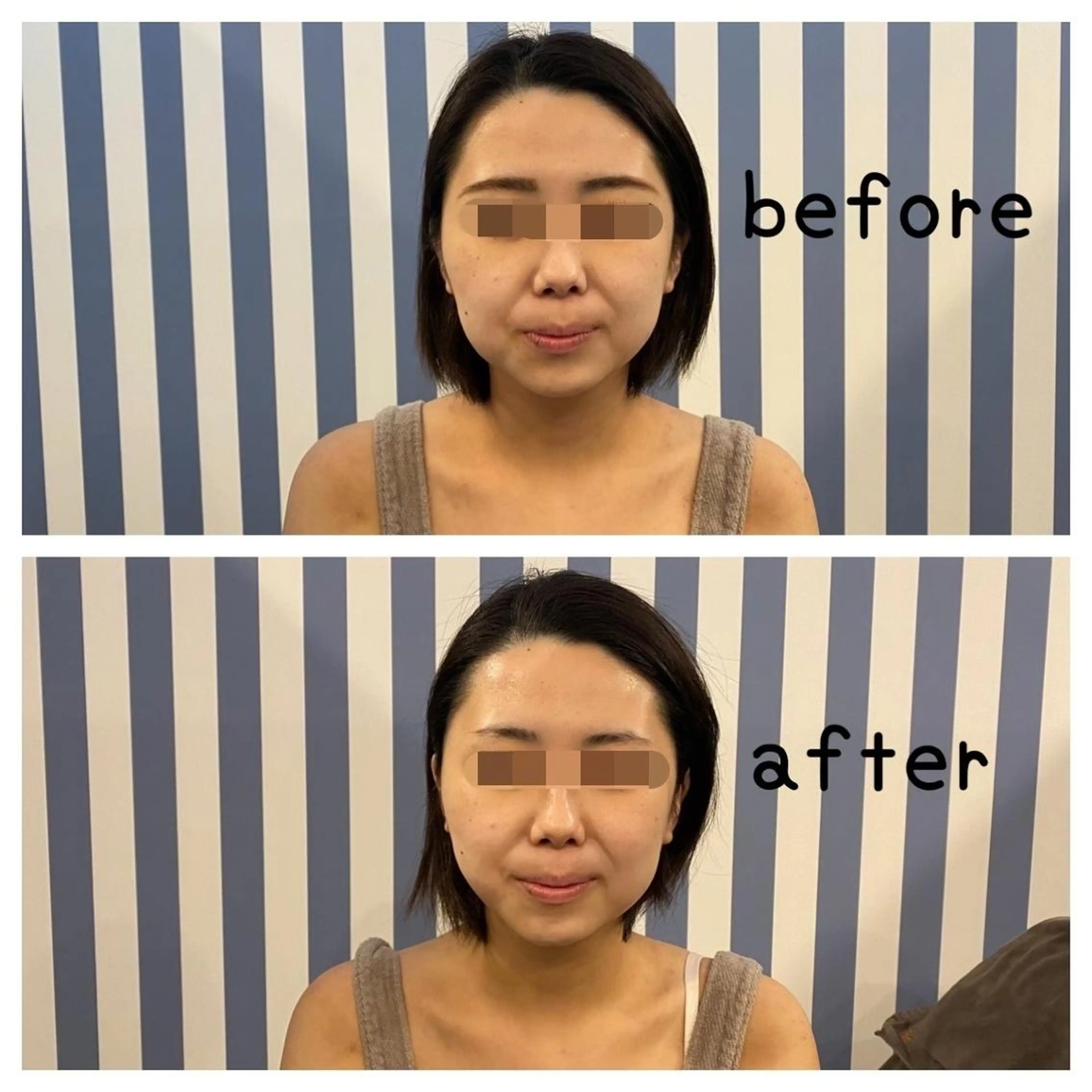 Eclat ALICEのその他イメージ