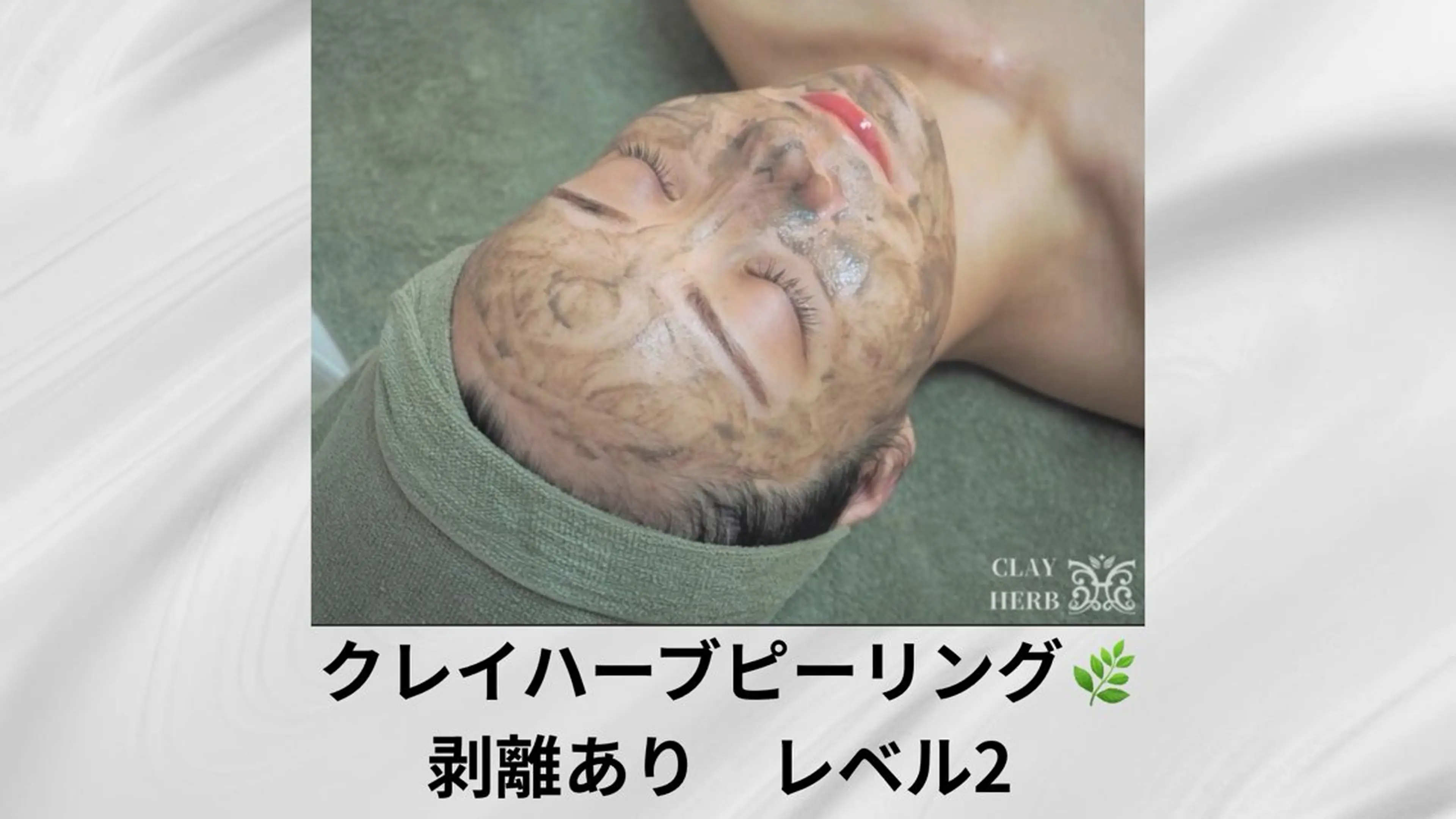 【しっかり変化】剥離ありハーブ2倍で肌質改善の写真
