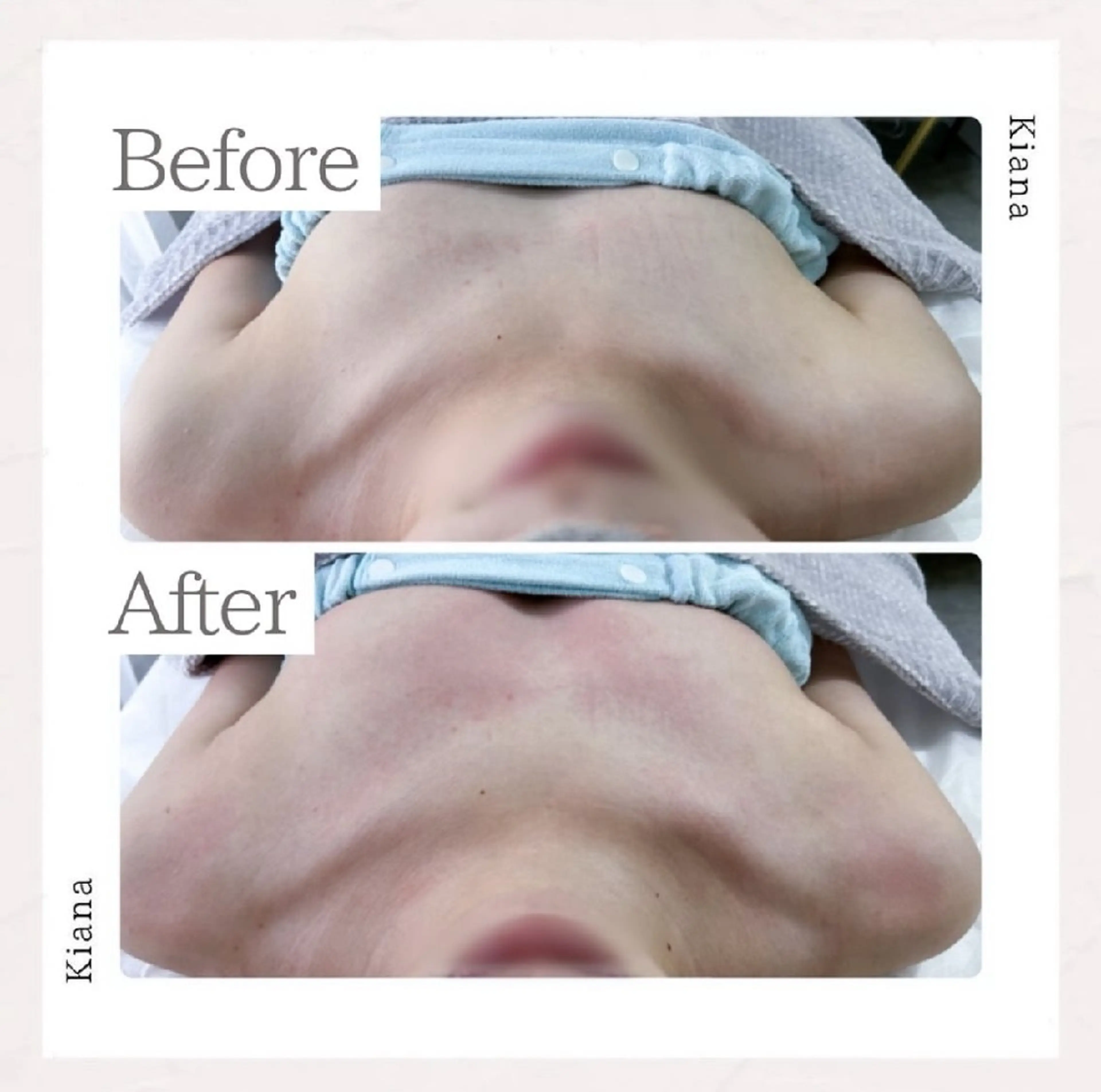 エステ リラク 【バスト専門店 】 Kiana のエステ・リラクイメージ