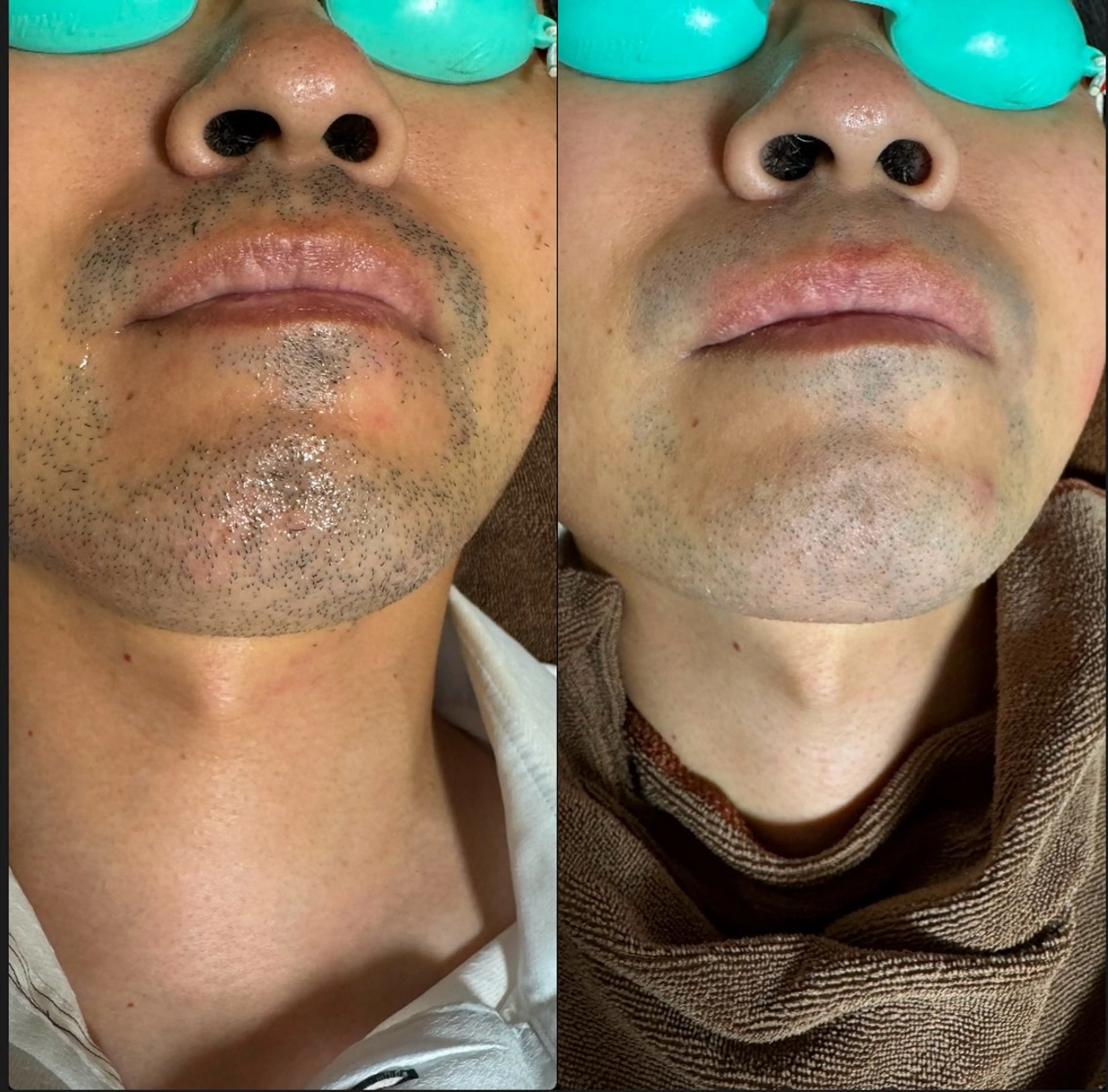 六本木脱毛andS 店長Sachiのエステ・リラクイメージ