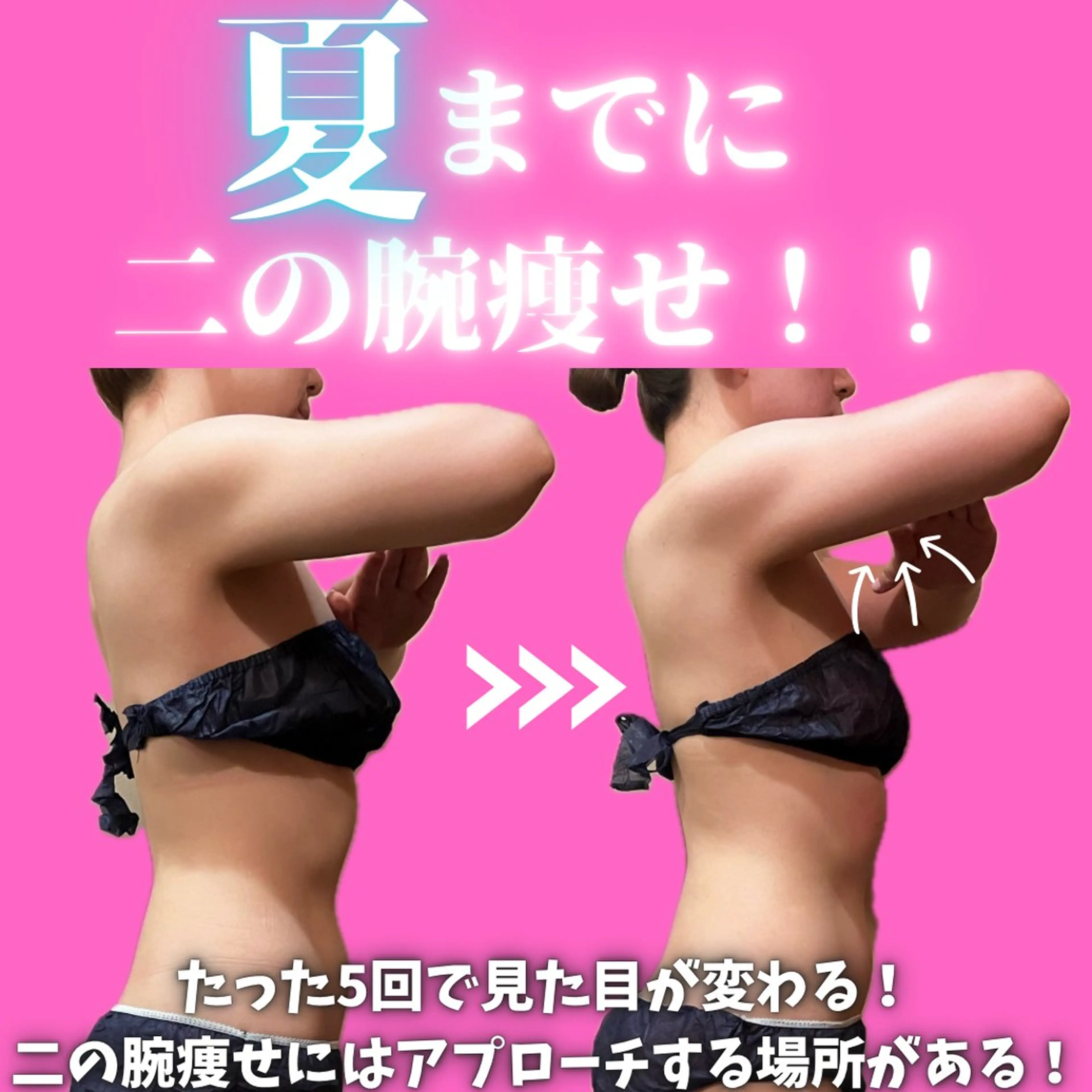 ハイパーナイフ超え🔥ラジオ派の最高峰機械で全身のこりやセルライト、むくみを徹底排除✊🏻痩せる体質でリバウンドなし🌱の写真