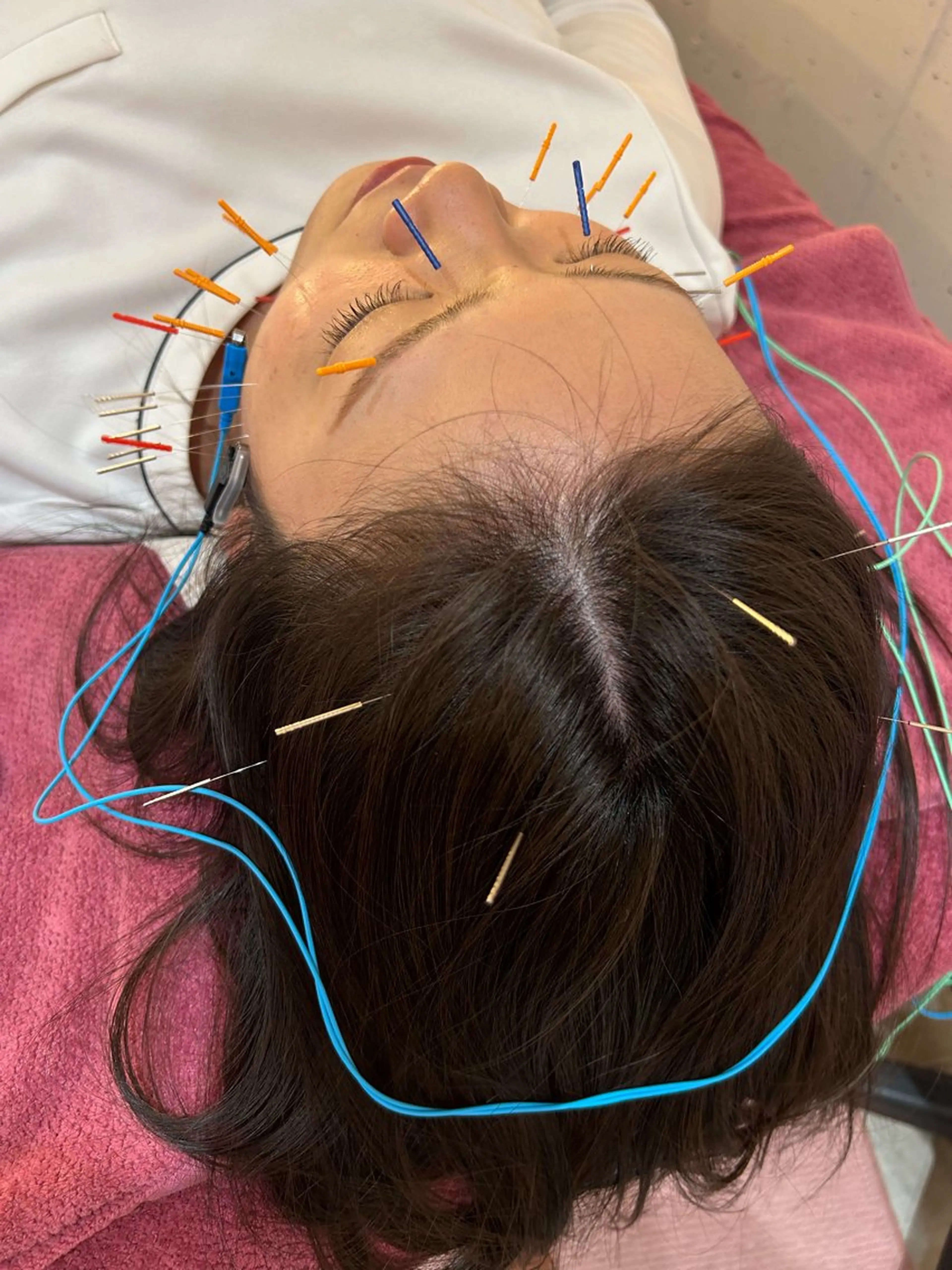 エステ リラク 美容鍼灸女性専用 りんご鍼灸治療院のその他イメージ