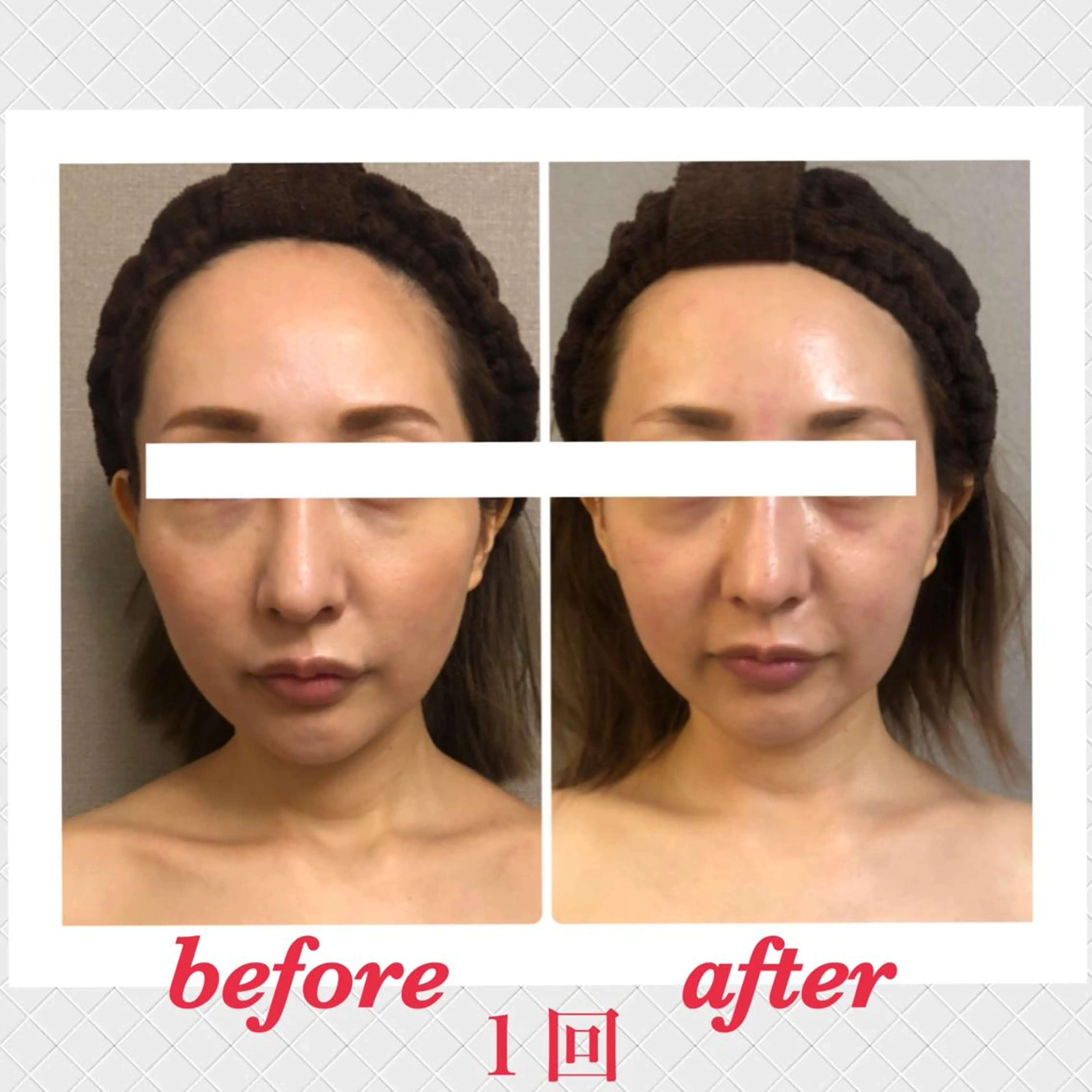 エステ 美ola ビオラのエステ・リラクイメージ