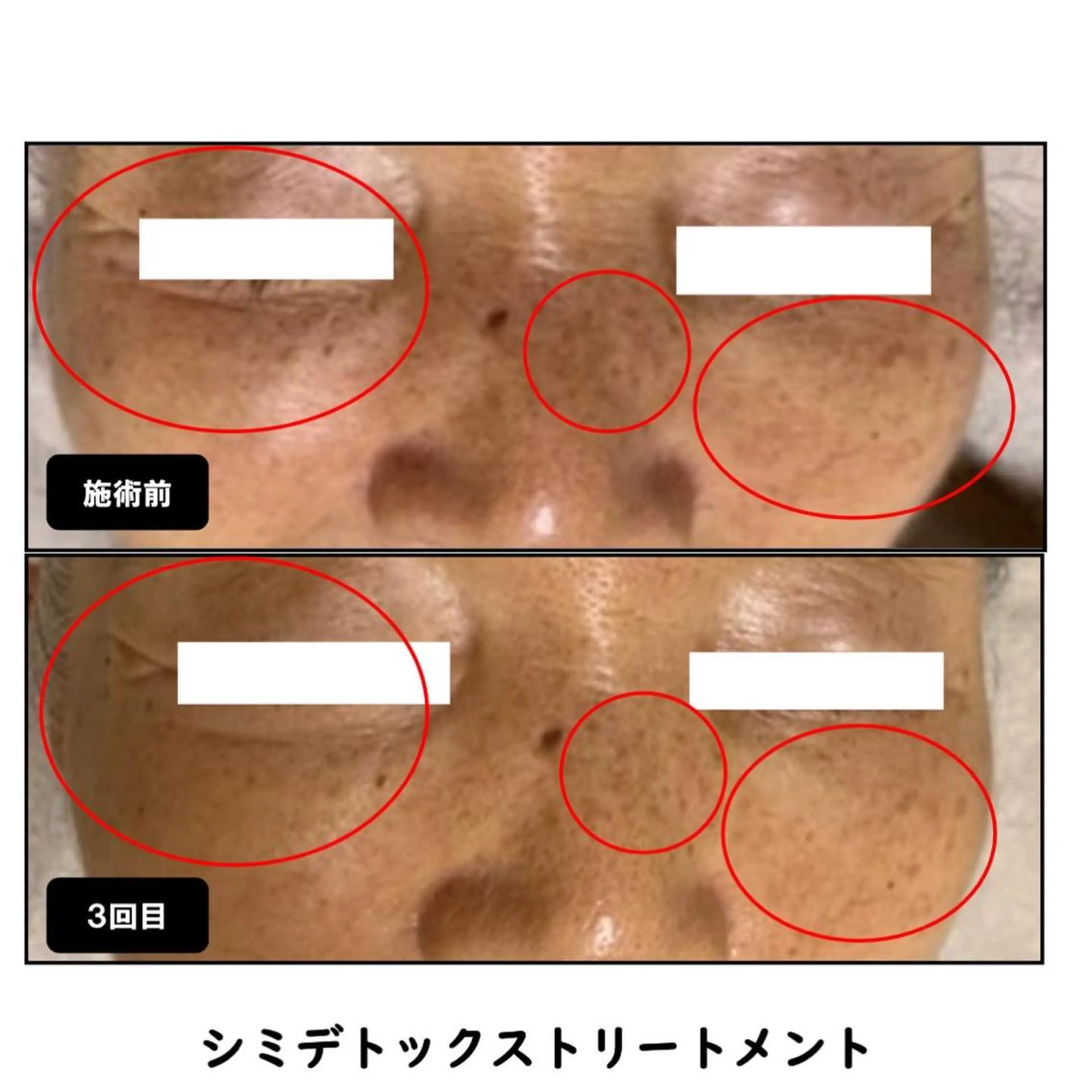 エステ ヴィーナス ビューティーのエステ・リラクイメージ