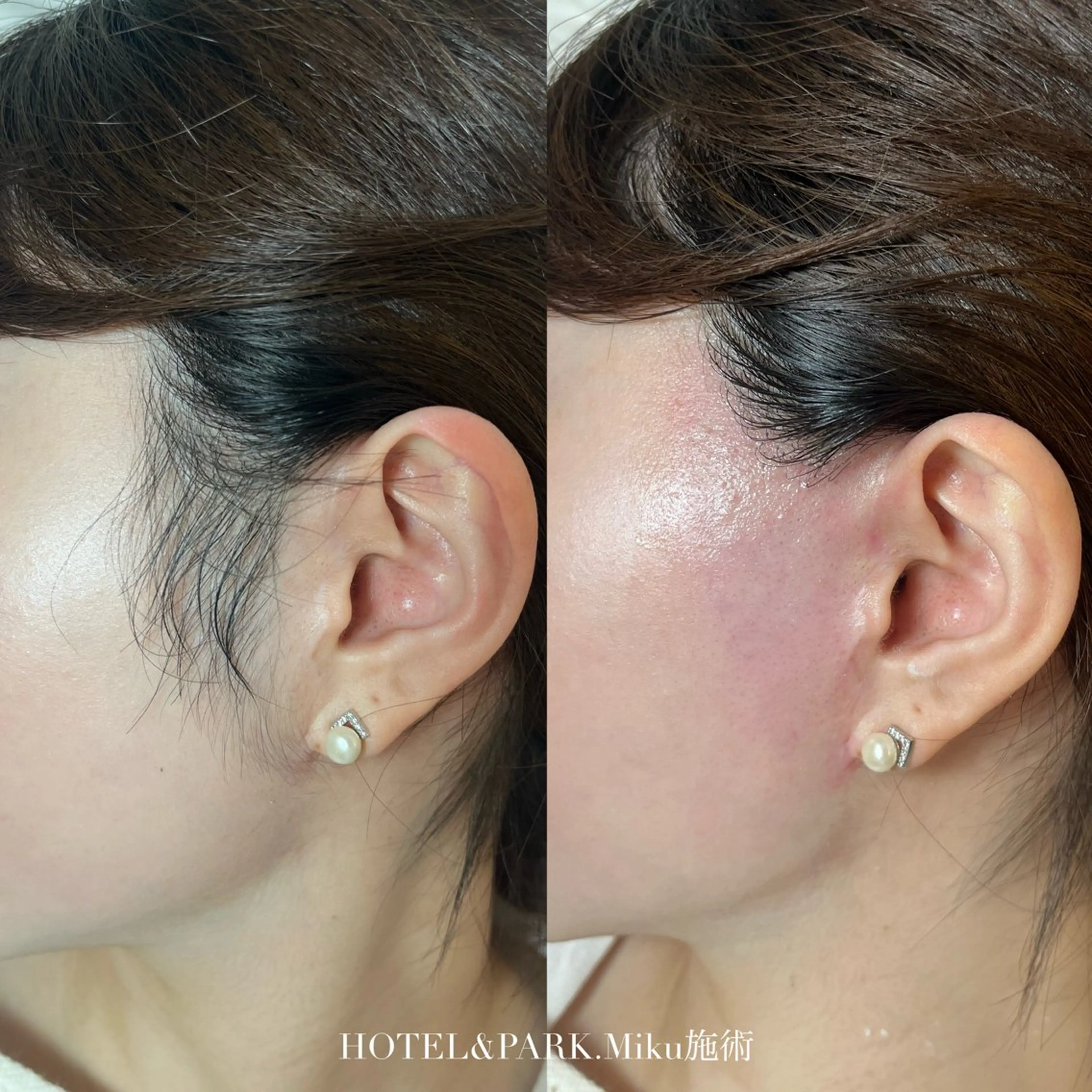 脱毛 HOTEL&PARK Mikuワックス脱毛のエステ・リラクイメージ