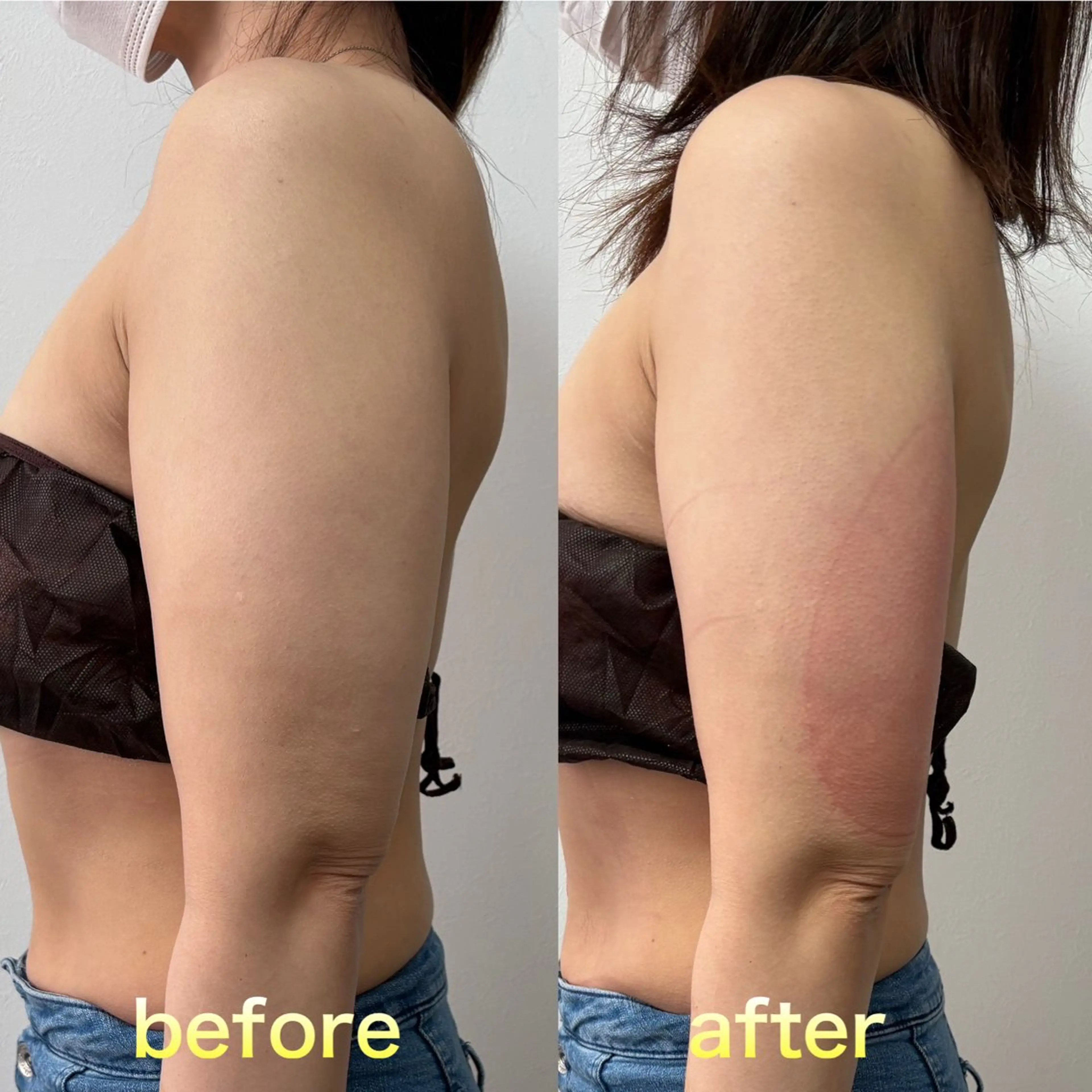 Miiju.所属・石巻 冷却痩身 Miiju. 鈴木のエステ・リラクイメージ