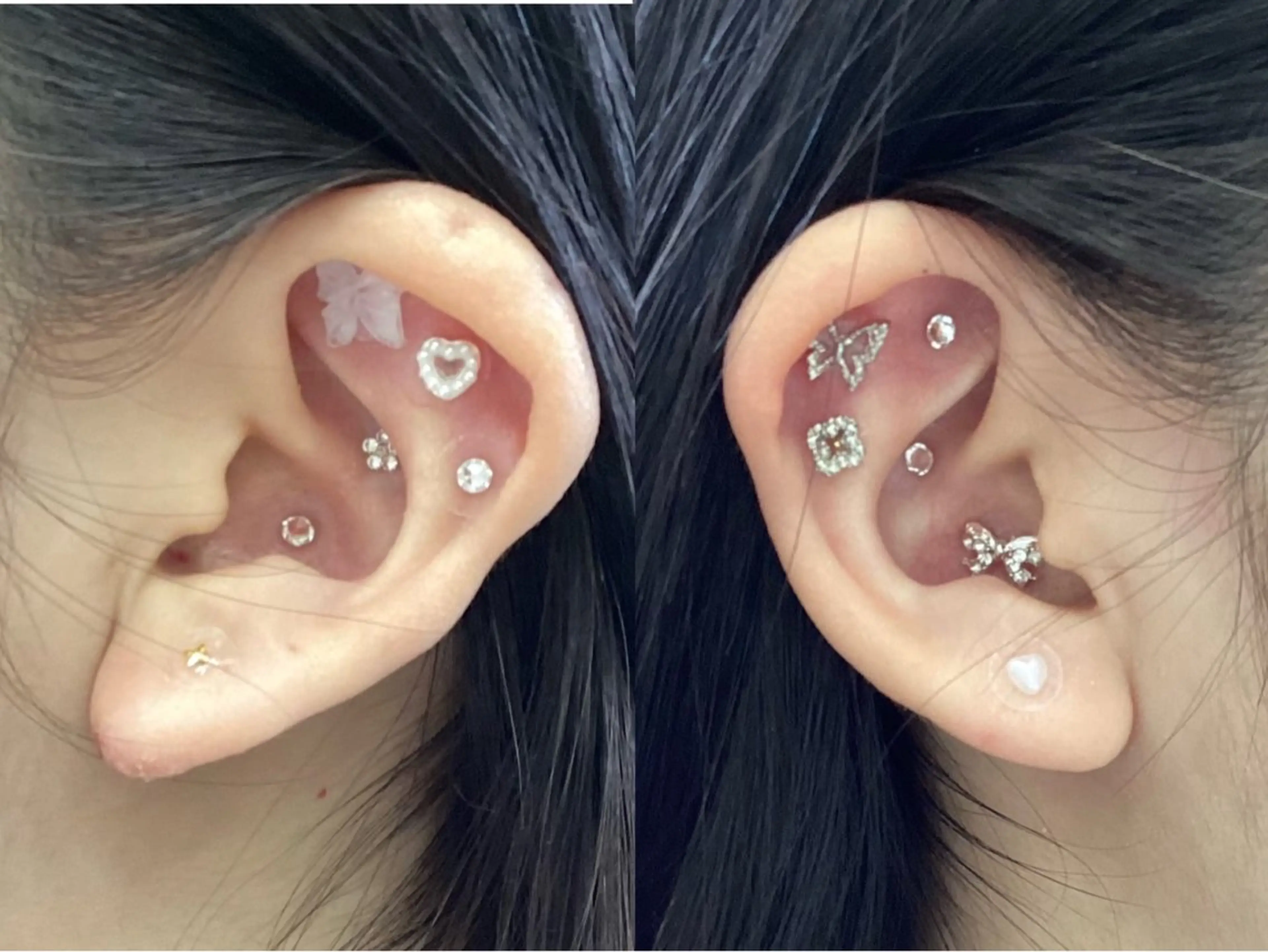 ◯△□所属・最新美肌脱毛 韓国水光肌🫧のその他イメージ