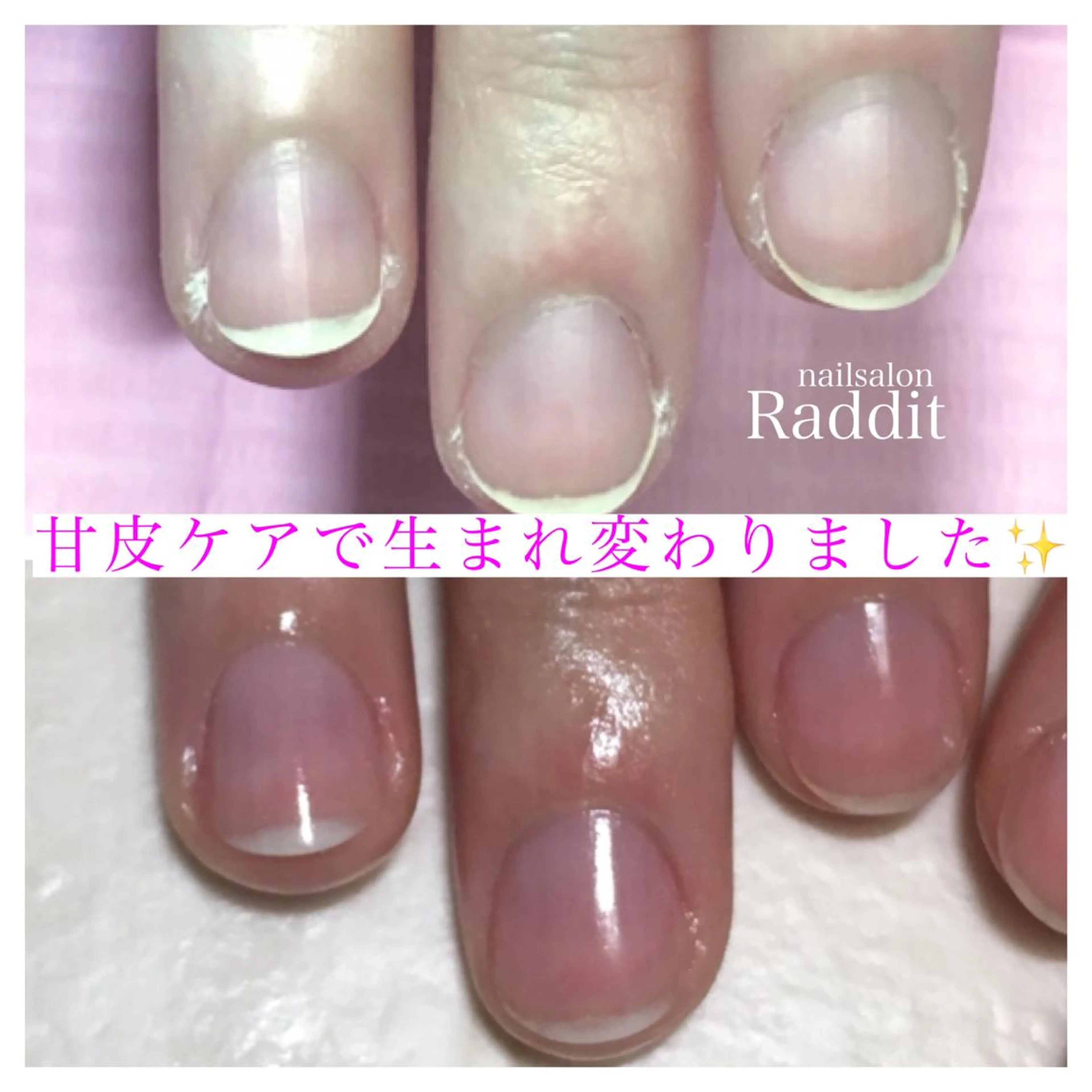 ネイル nailsalon Radditのネイルデザイン