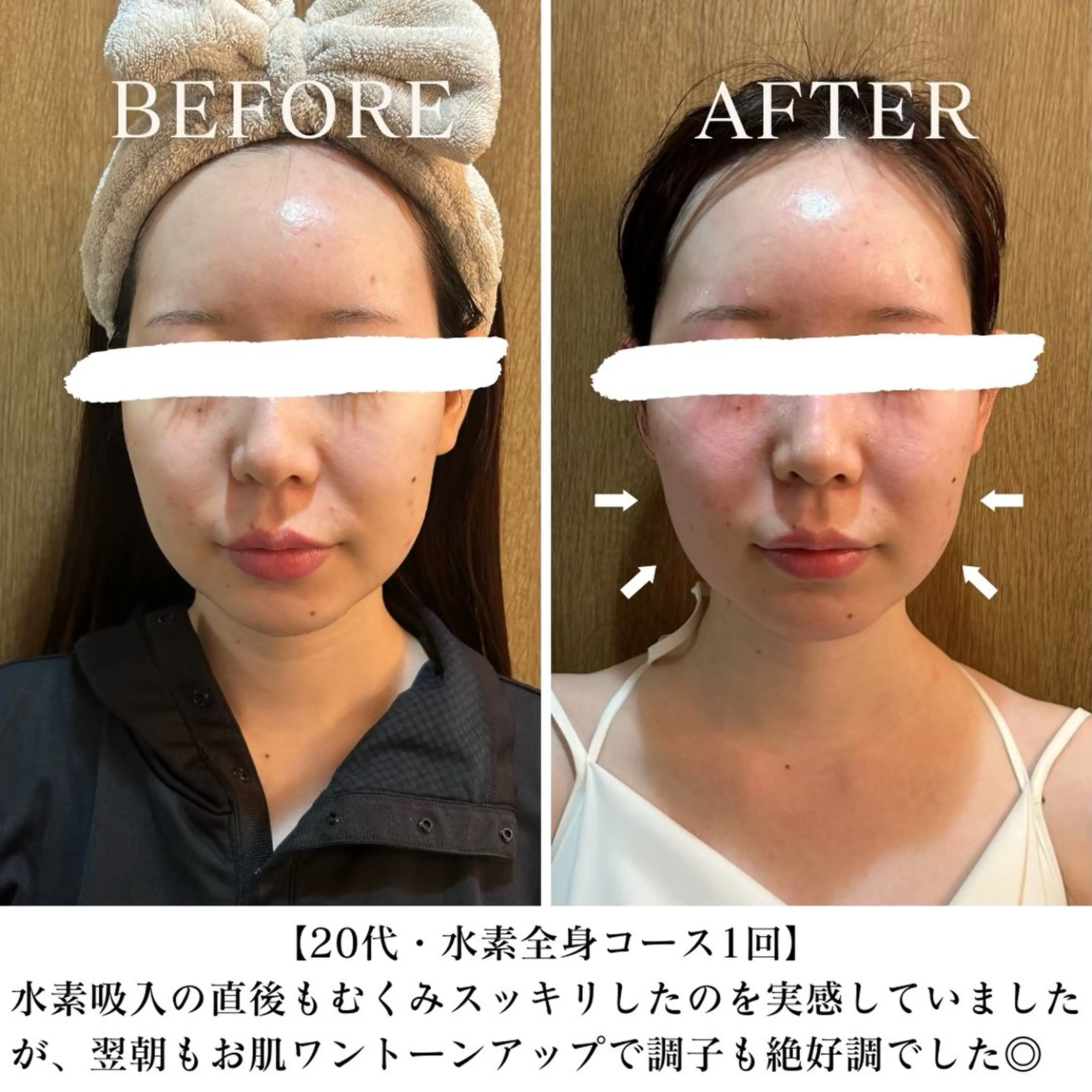 【西荻窪】本格痩身 最新型よもぎ蒸しのエステ・リラクイメージ