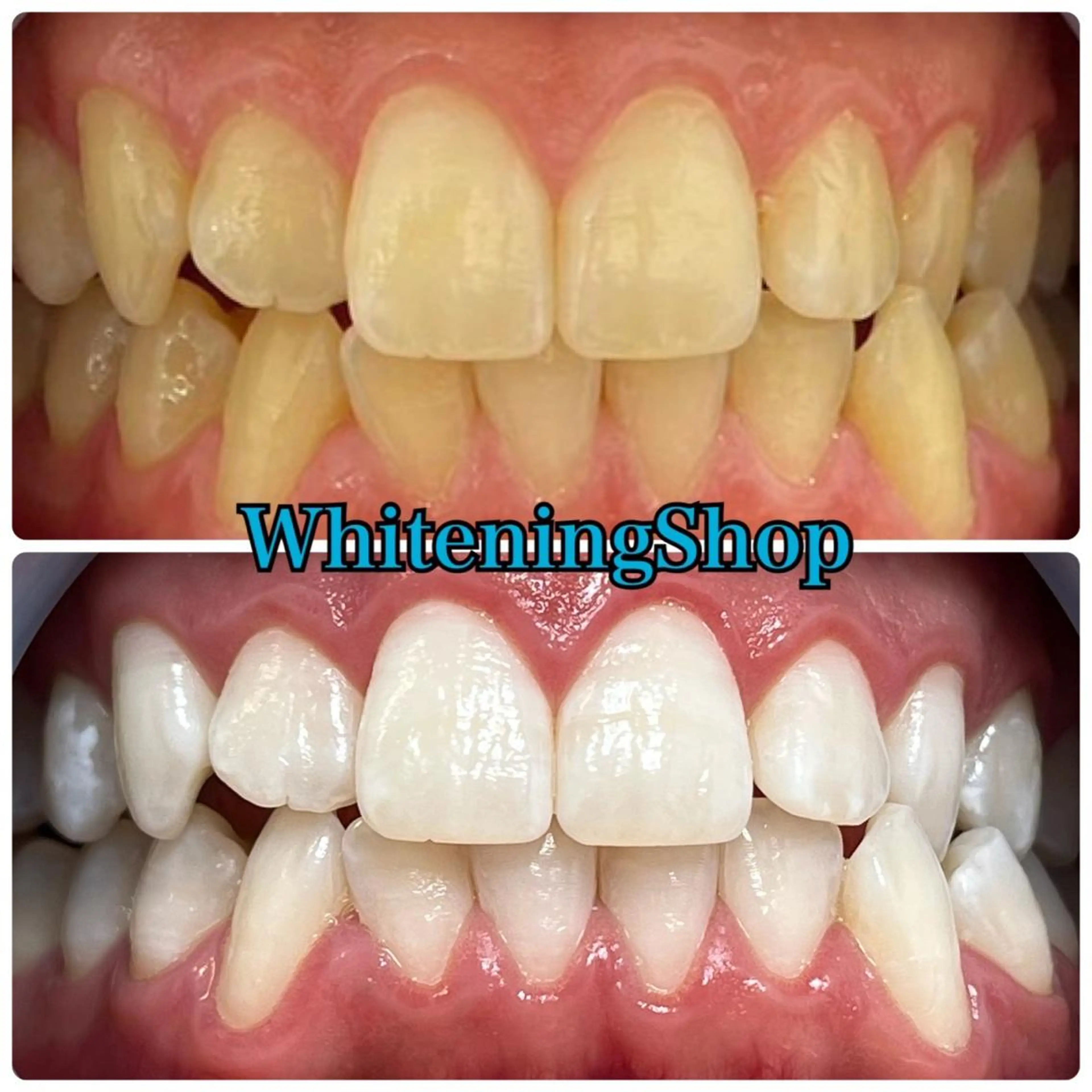 ホワイトニング ショップ吉祥寺店のエステ・リラクイメージ