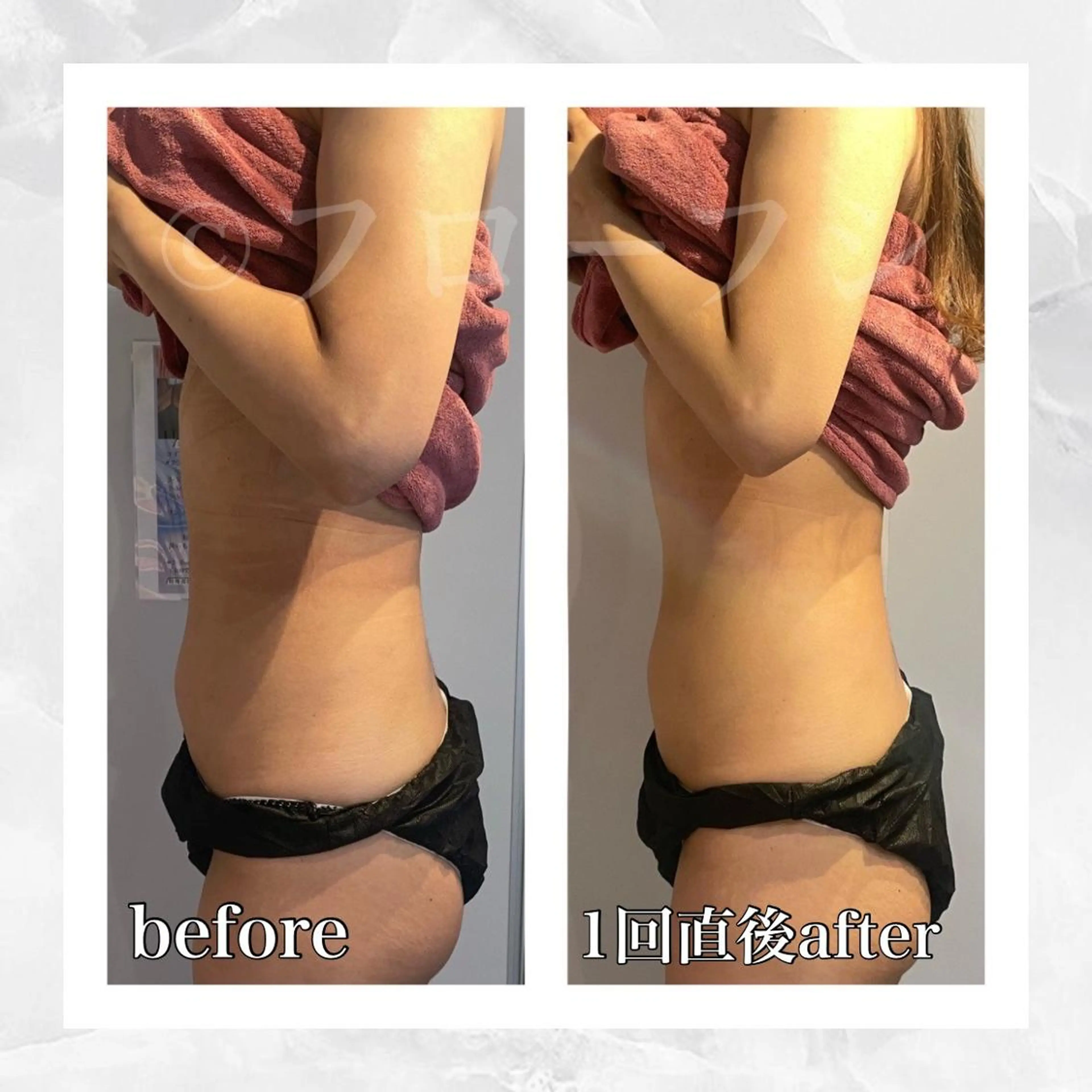 エステ リラク 部分痩せ♥️小顔専門 MIKUのエステ・リラクイメージ