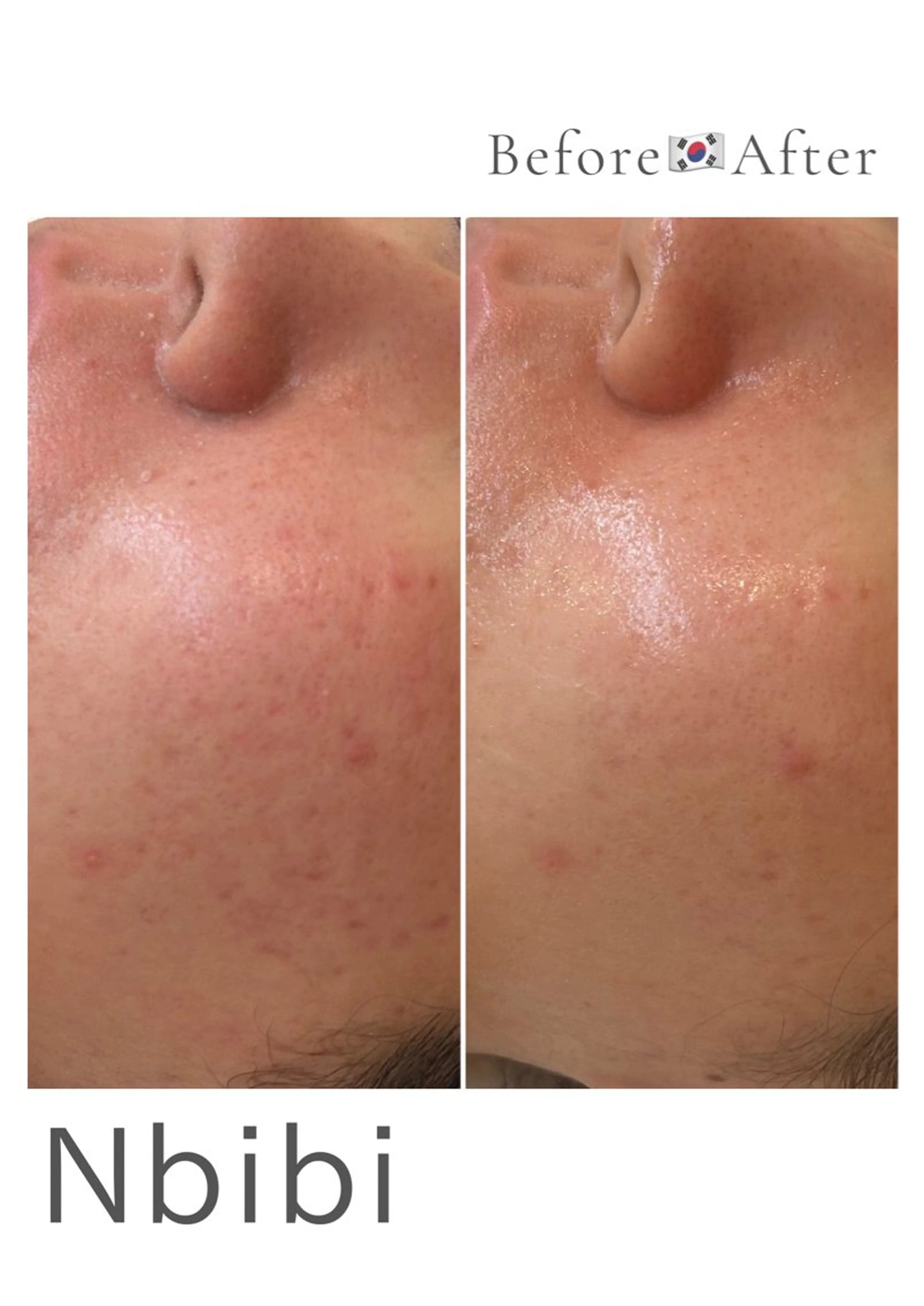 韓国🇰🇷価格 サロン_Nbibiの眉毛・アイブロウイメージ