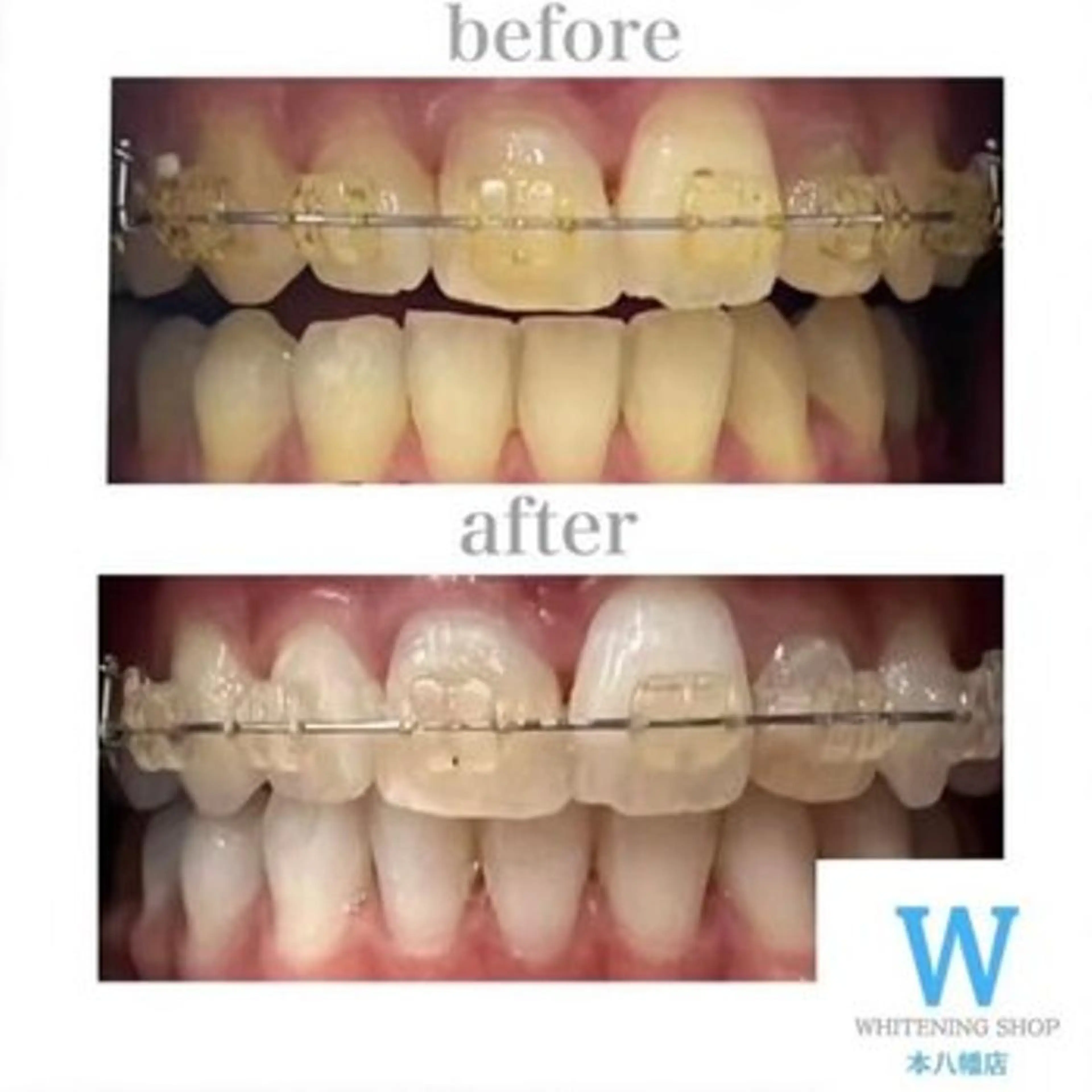 メンズ エステ リラク ホワイトニング ショップ船橋２号店のエステ・リラクイメージ