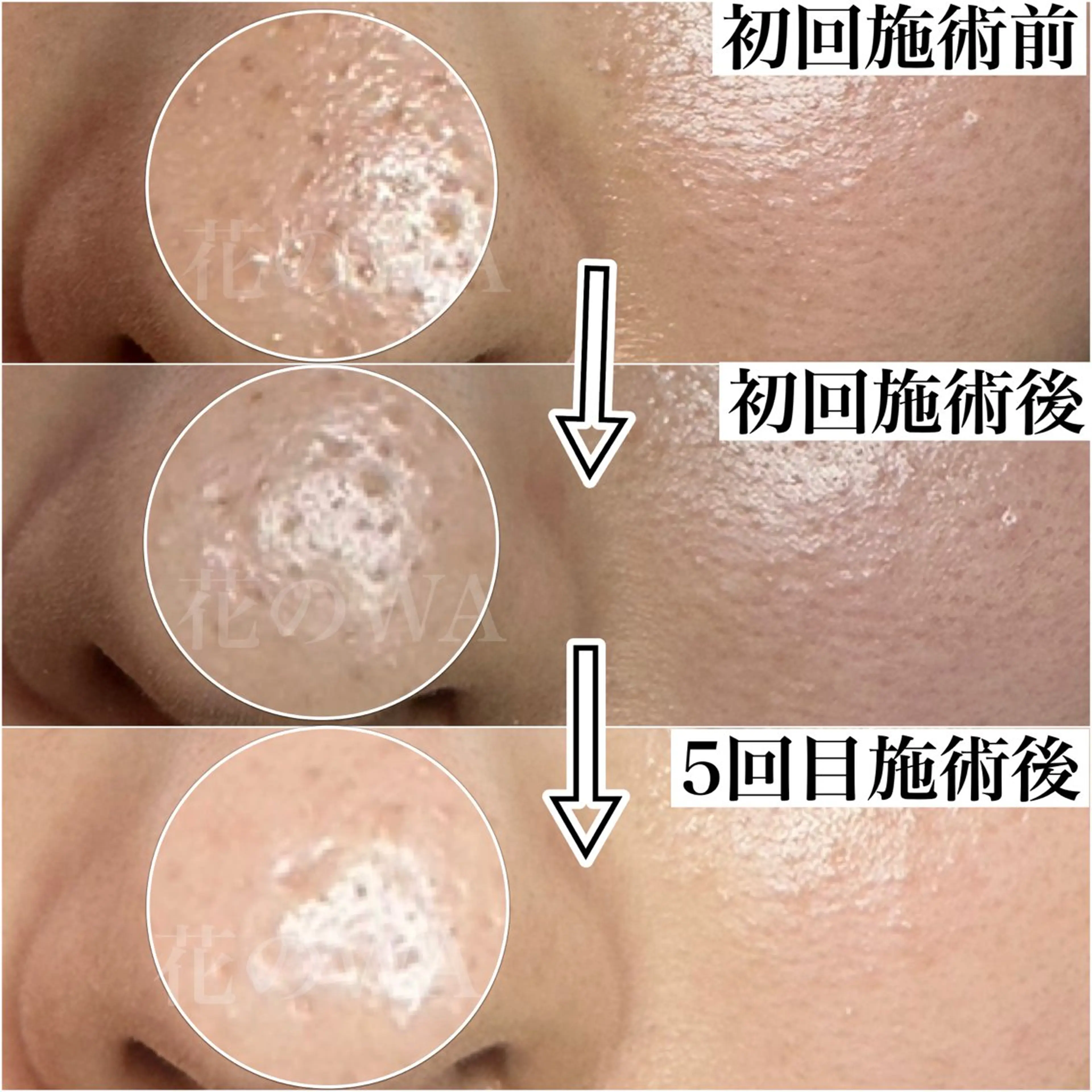 エステ リラク 毛穴&リンパマッサー ジ専門サロン花のWAのエステ・リラクイメージ